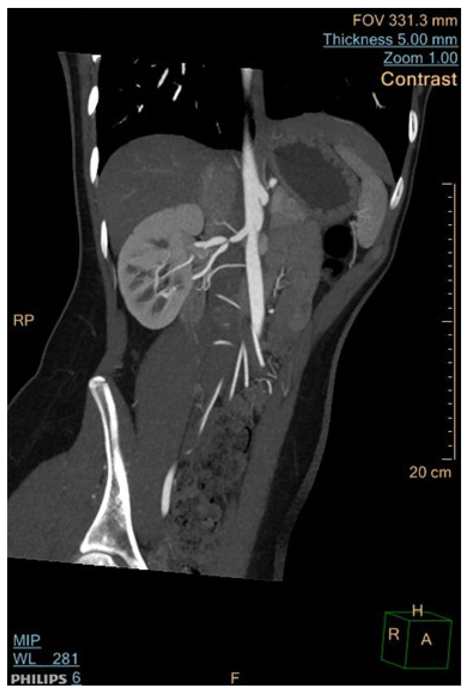 Jcm 13 06778 g007 Jcm 13 06778 g007
