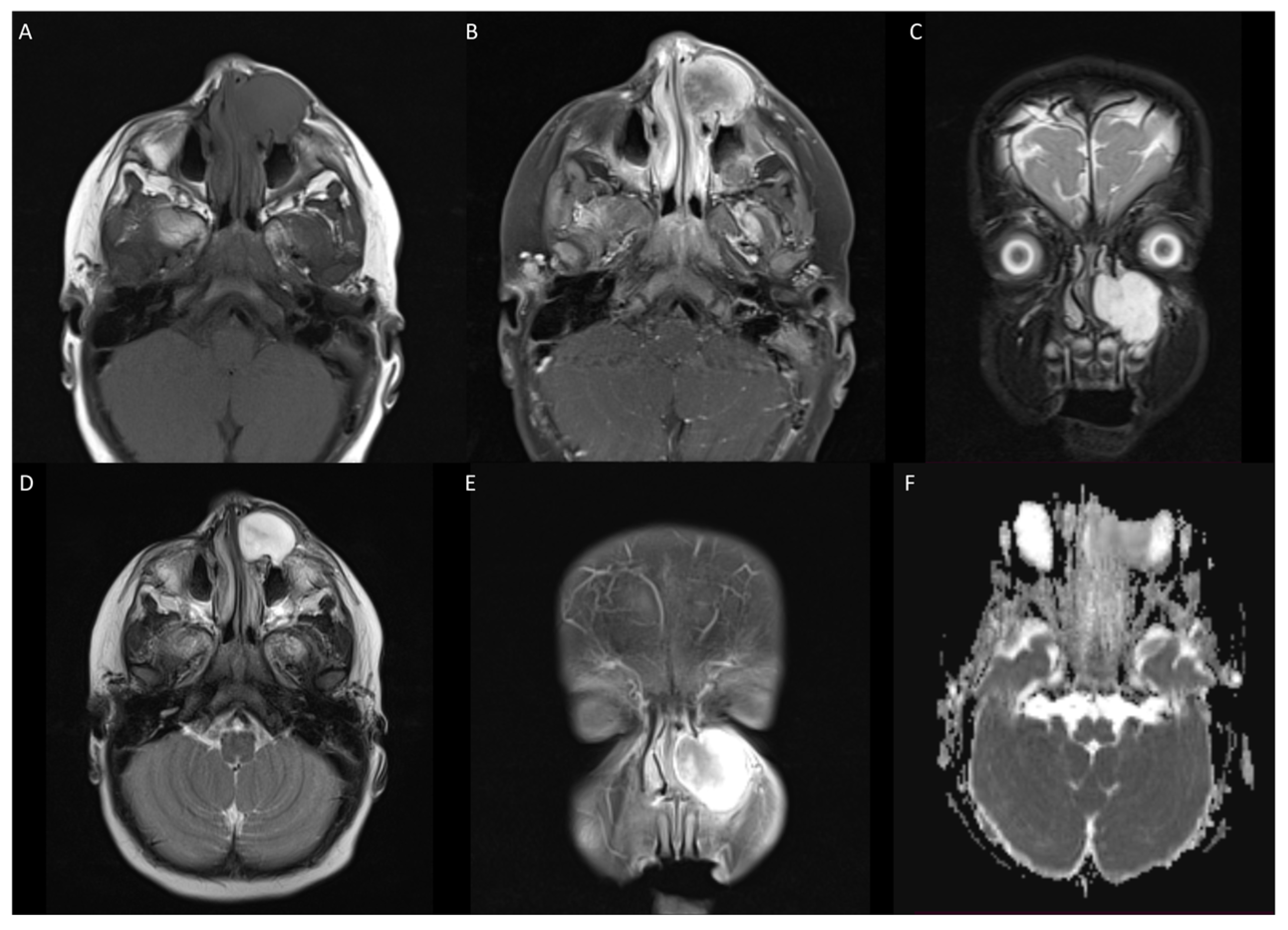 Jcm 13 06818 g001 Jcm 13 06818 g001