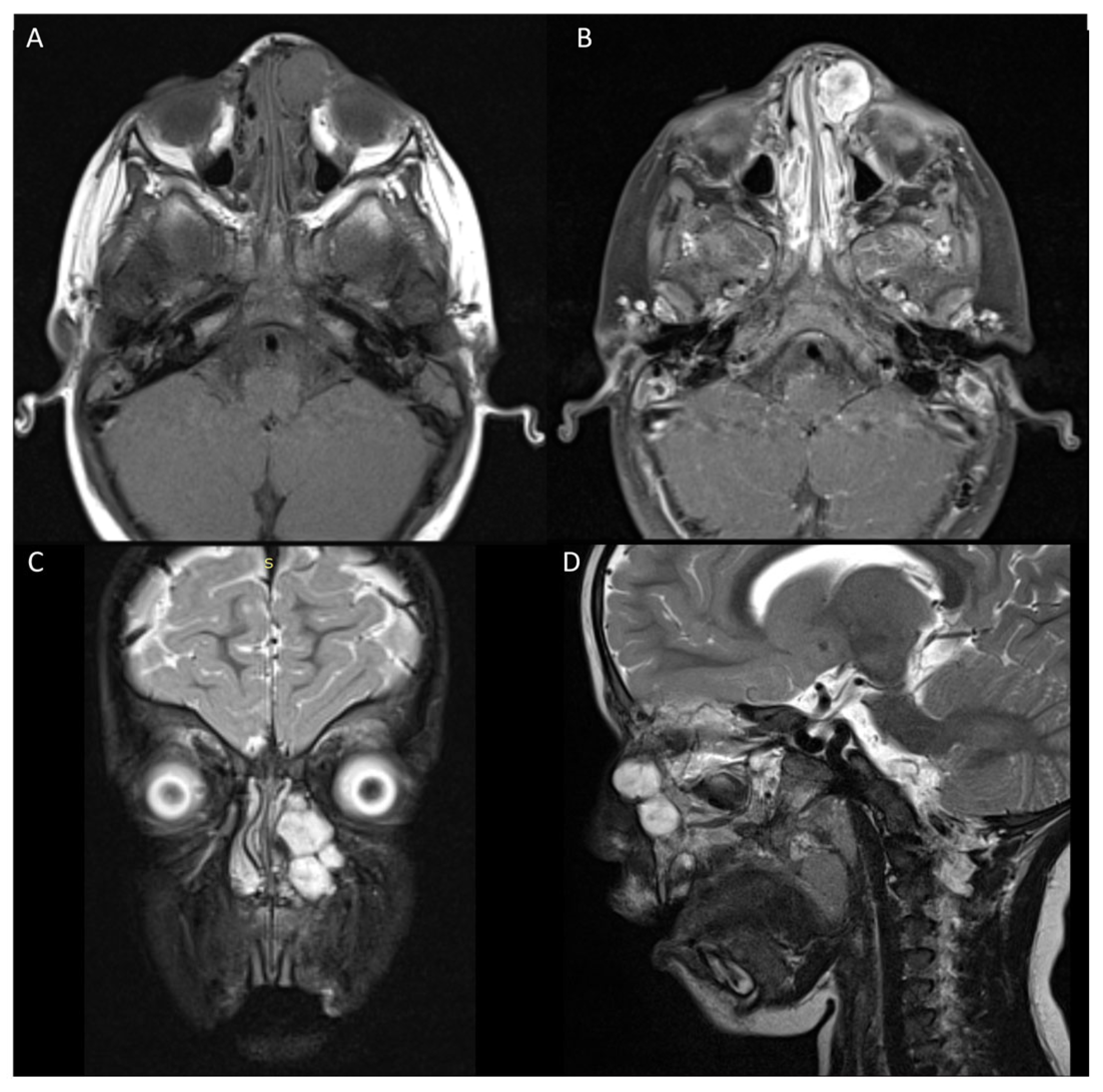 Jcm 13 06818 g003 Jcm 13 06818 g003