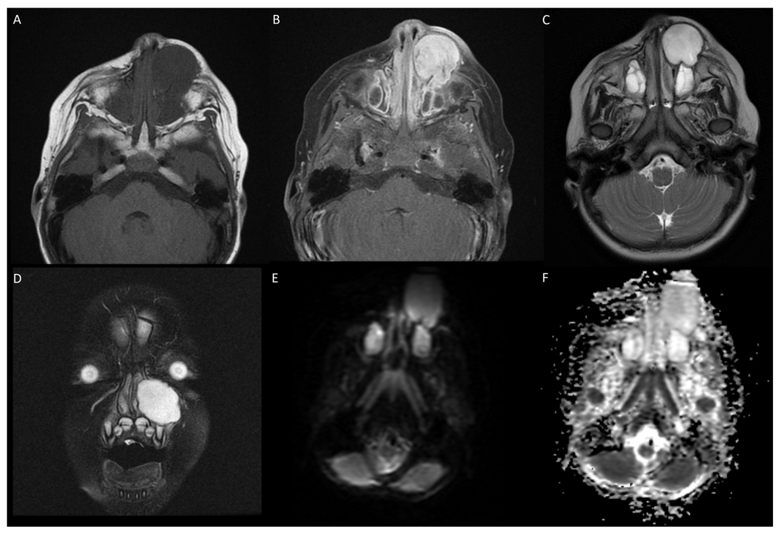 Jcm 13 06818 g004 Jcm 13 06818 g004