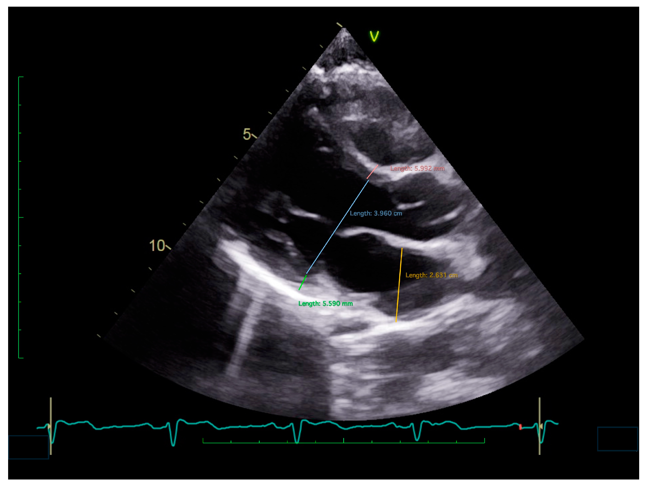 Jcm 13 06852 g004 Jcm 13 06852 g004