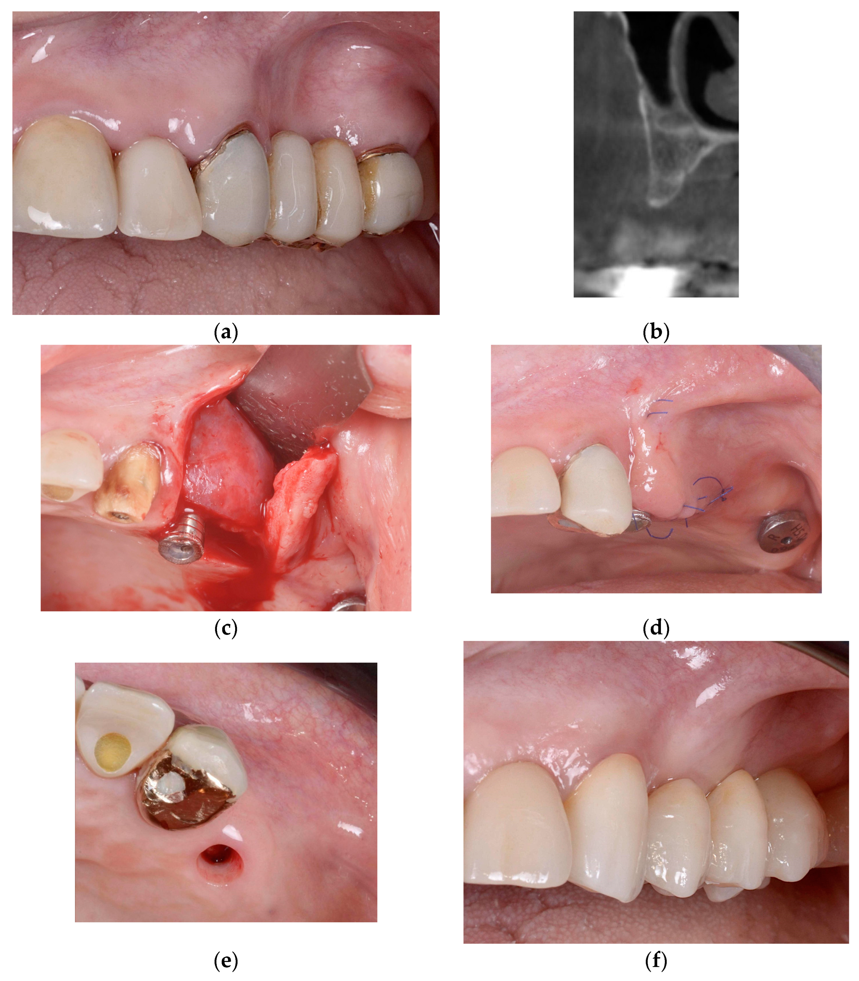 Jcm 13 06916 g001a Jcm 13 06916 g001a