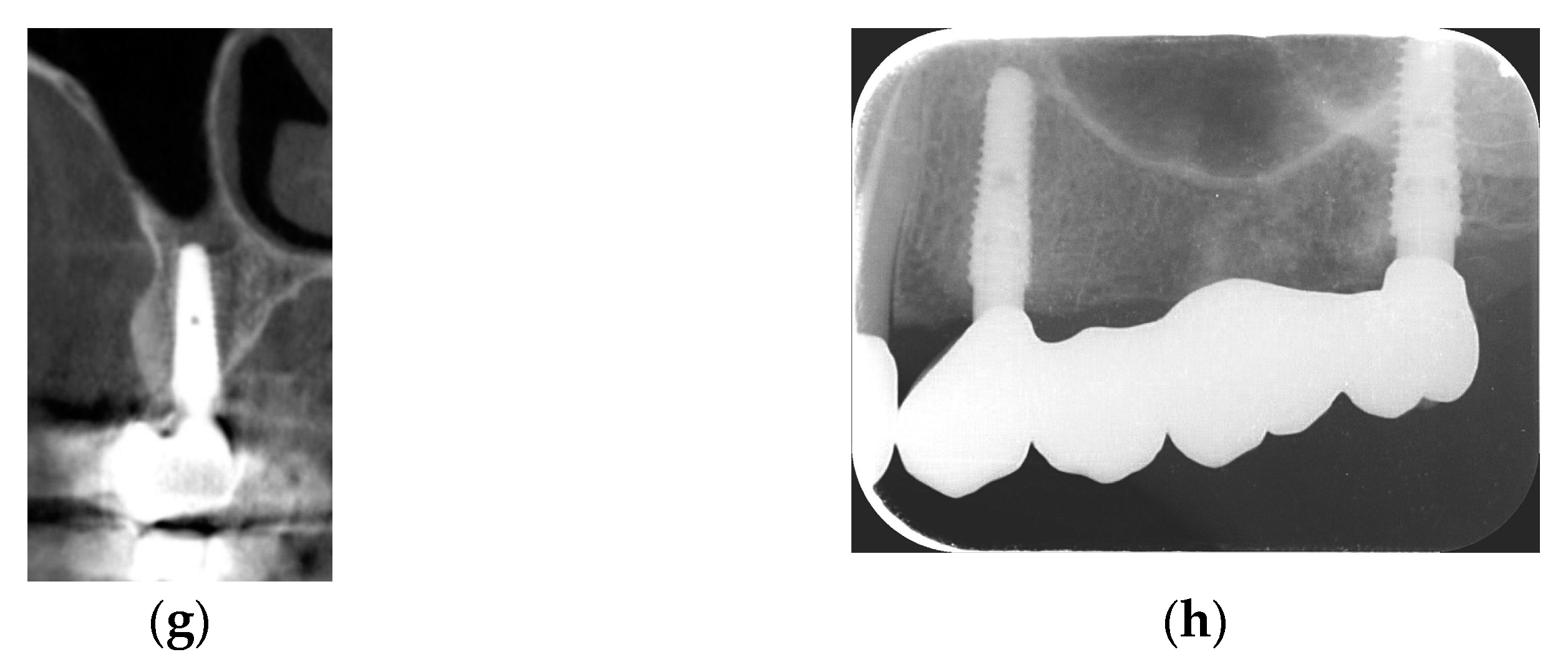 Jcm 13 06916 g001b Jcm 13 06916 g001b