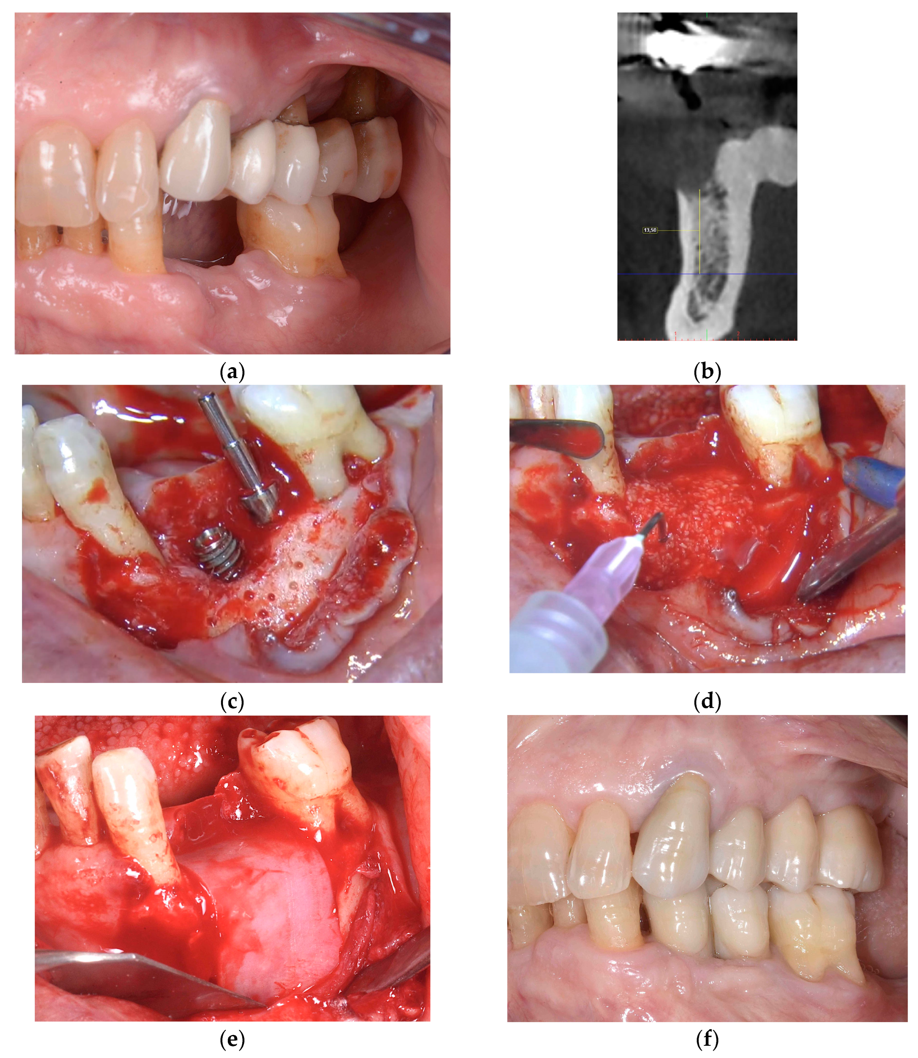 Jcm 13 06916 g002a Jcm 13 06916 g002a