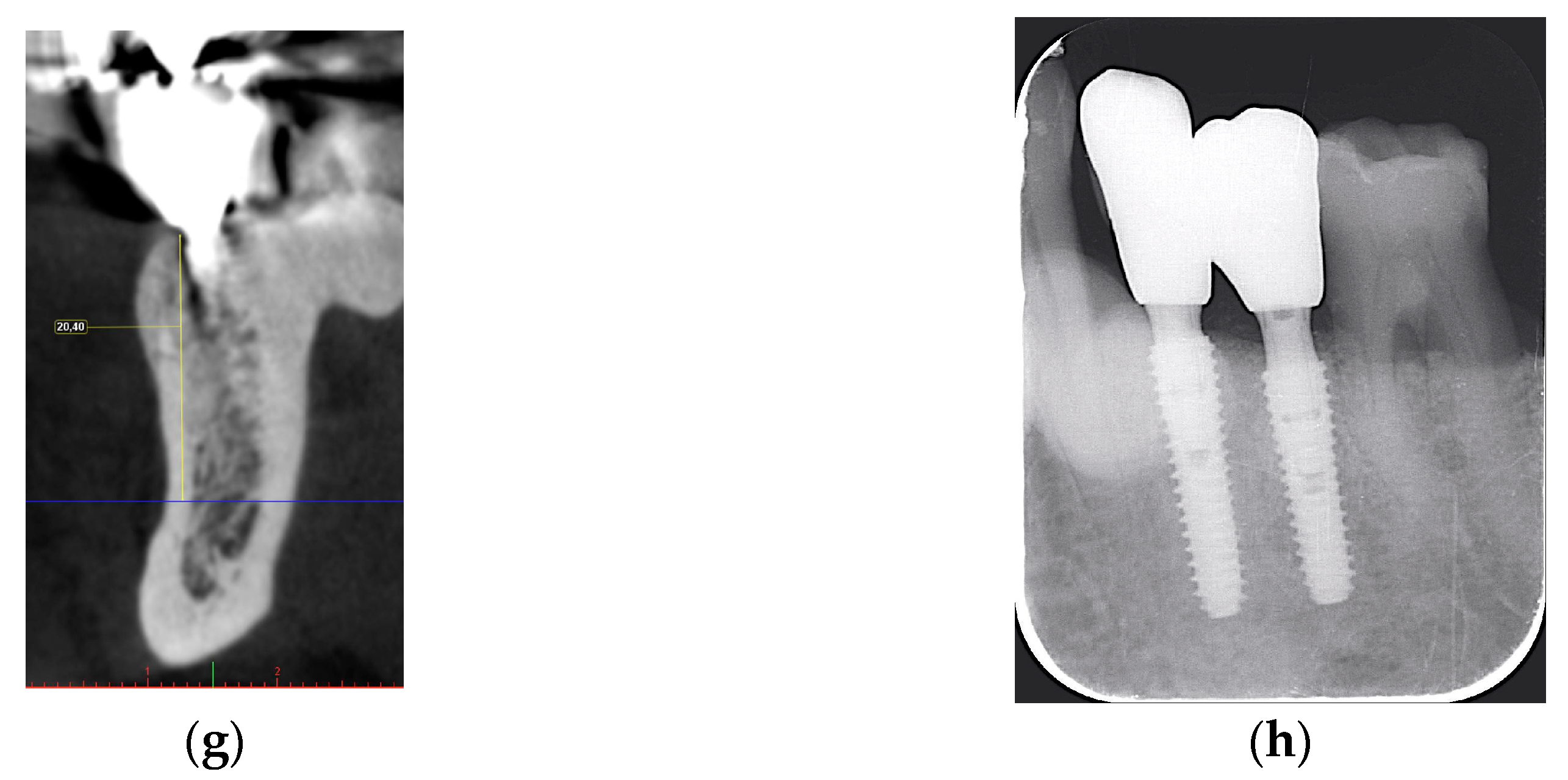 Jcm 13 06916 g002b Jcm 13 06916 g002b