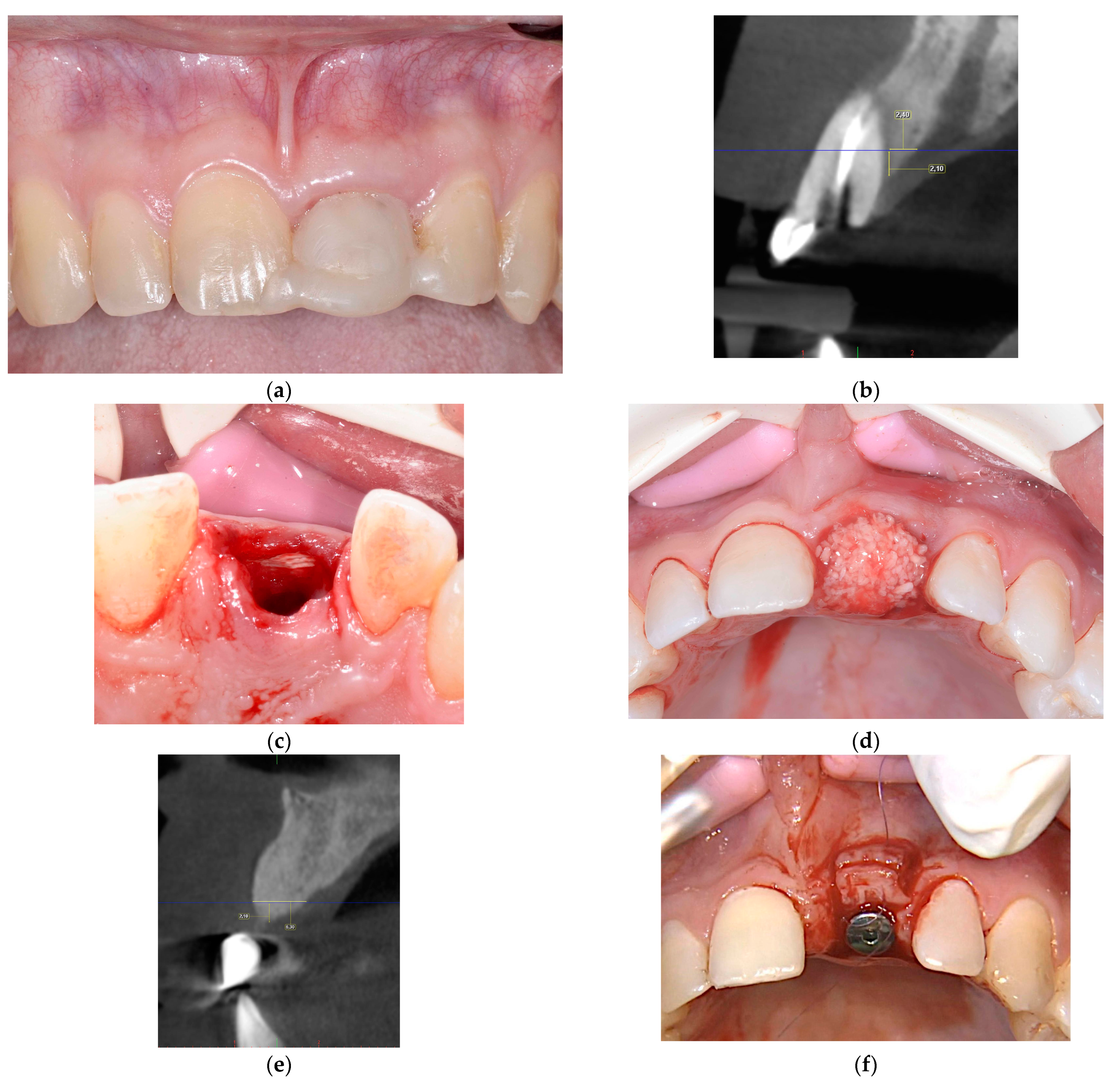 Jcm 13 06916 g004a Jcm 13 06916 g004a