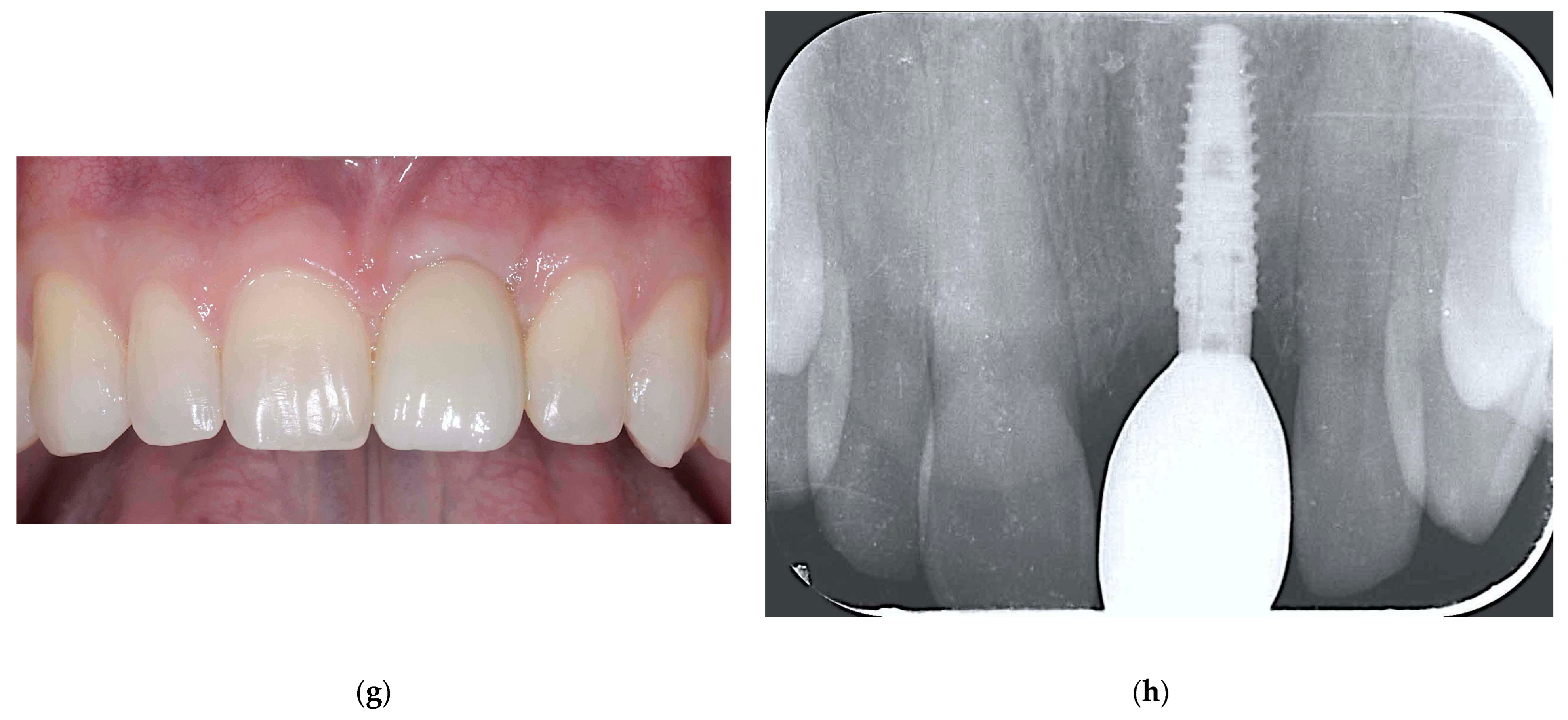 Jcm 13 06916 g004b Jcm 13 06916 g004b