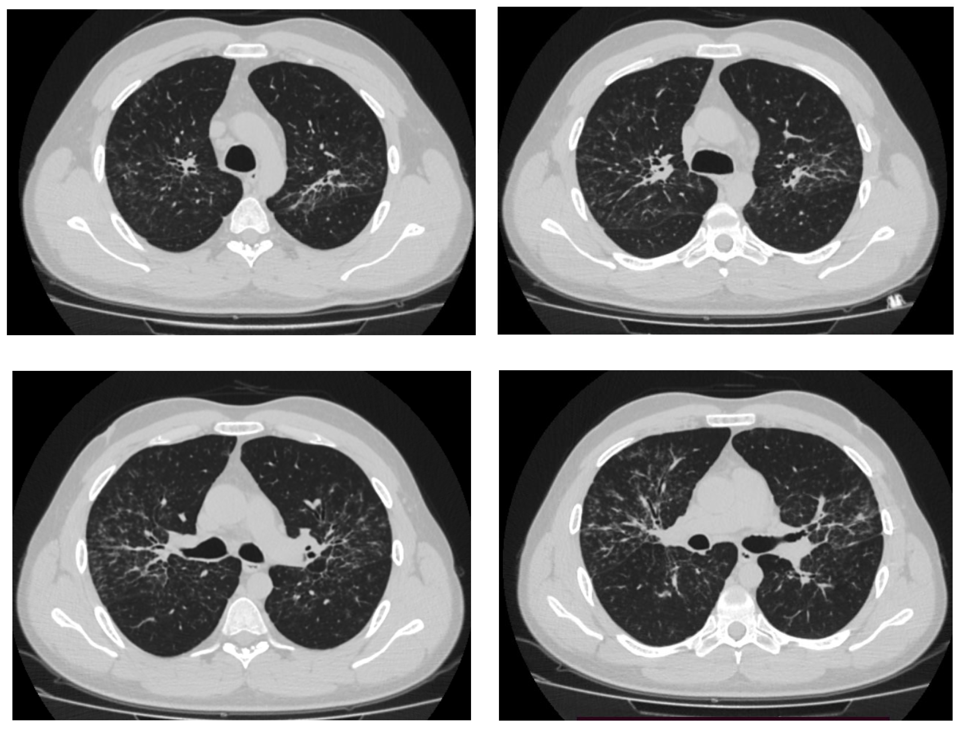 Jcm 13 06974 g001 Jcm 13 06974 g001