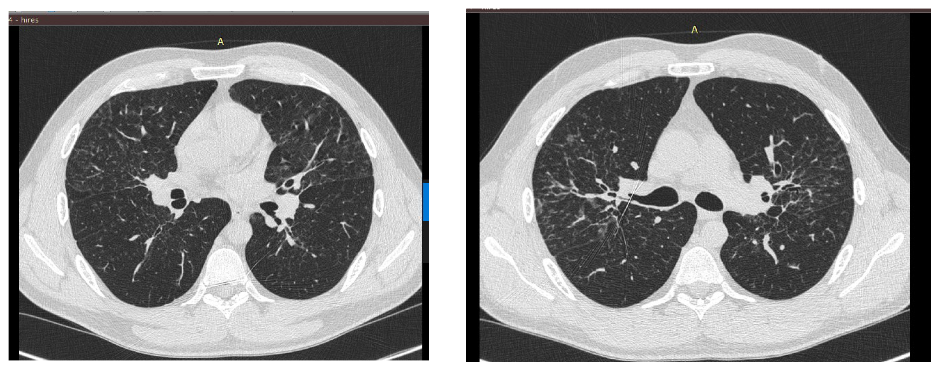 Jcm 13 06974 g002 Jcm 13 06974 g002