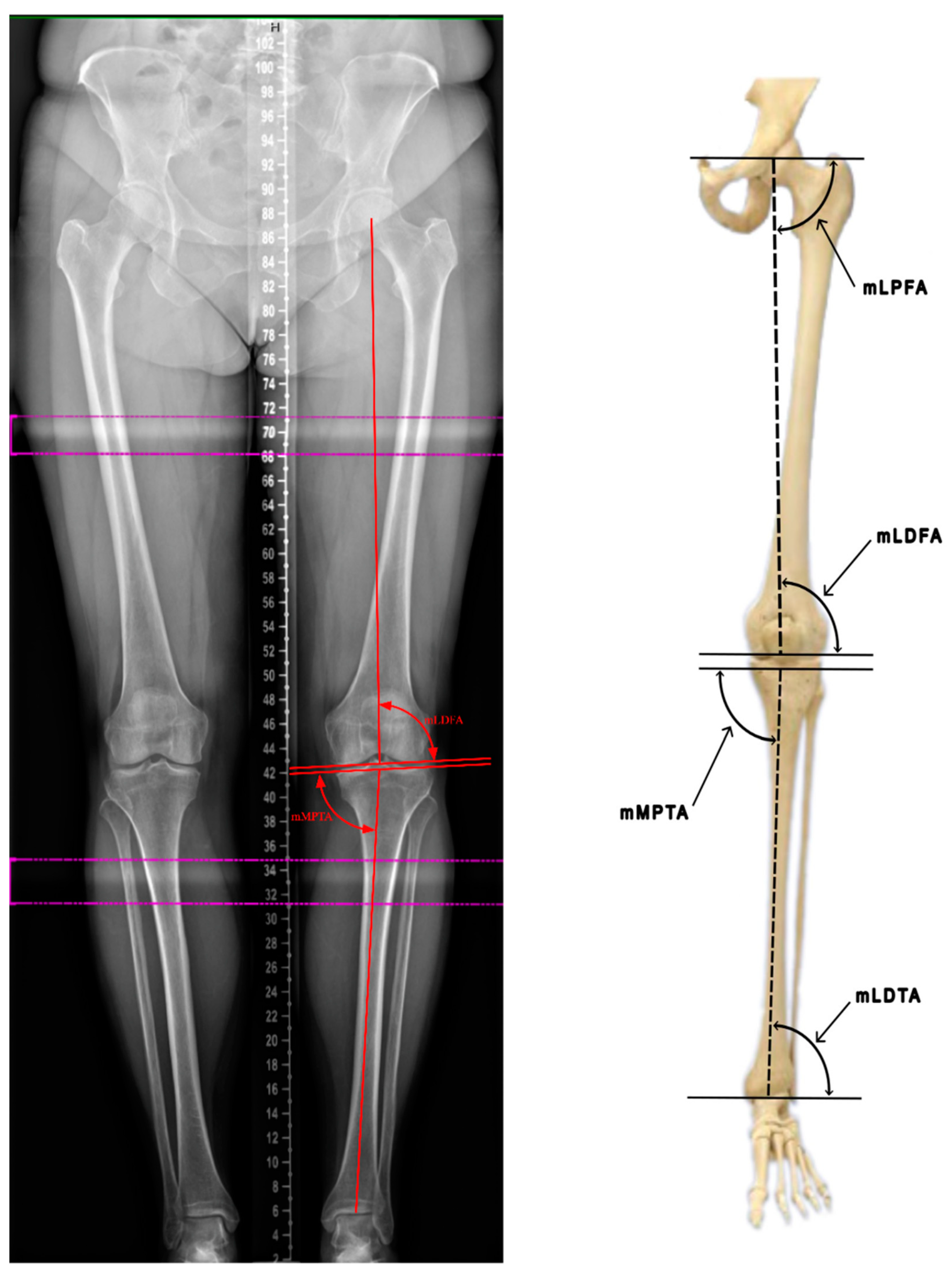 The Art of Limb Alignment, Twelfth Edition See more