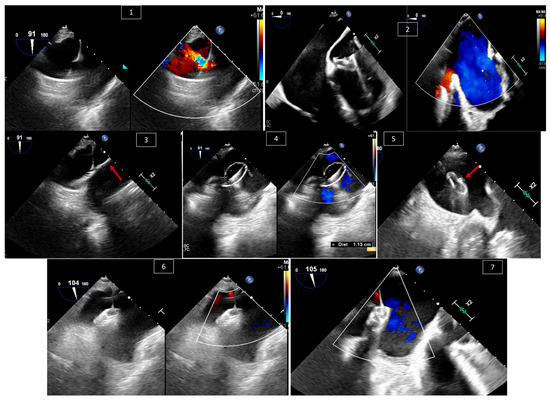 Echocardiography for Congenital Heart Disease: Fundamental