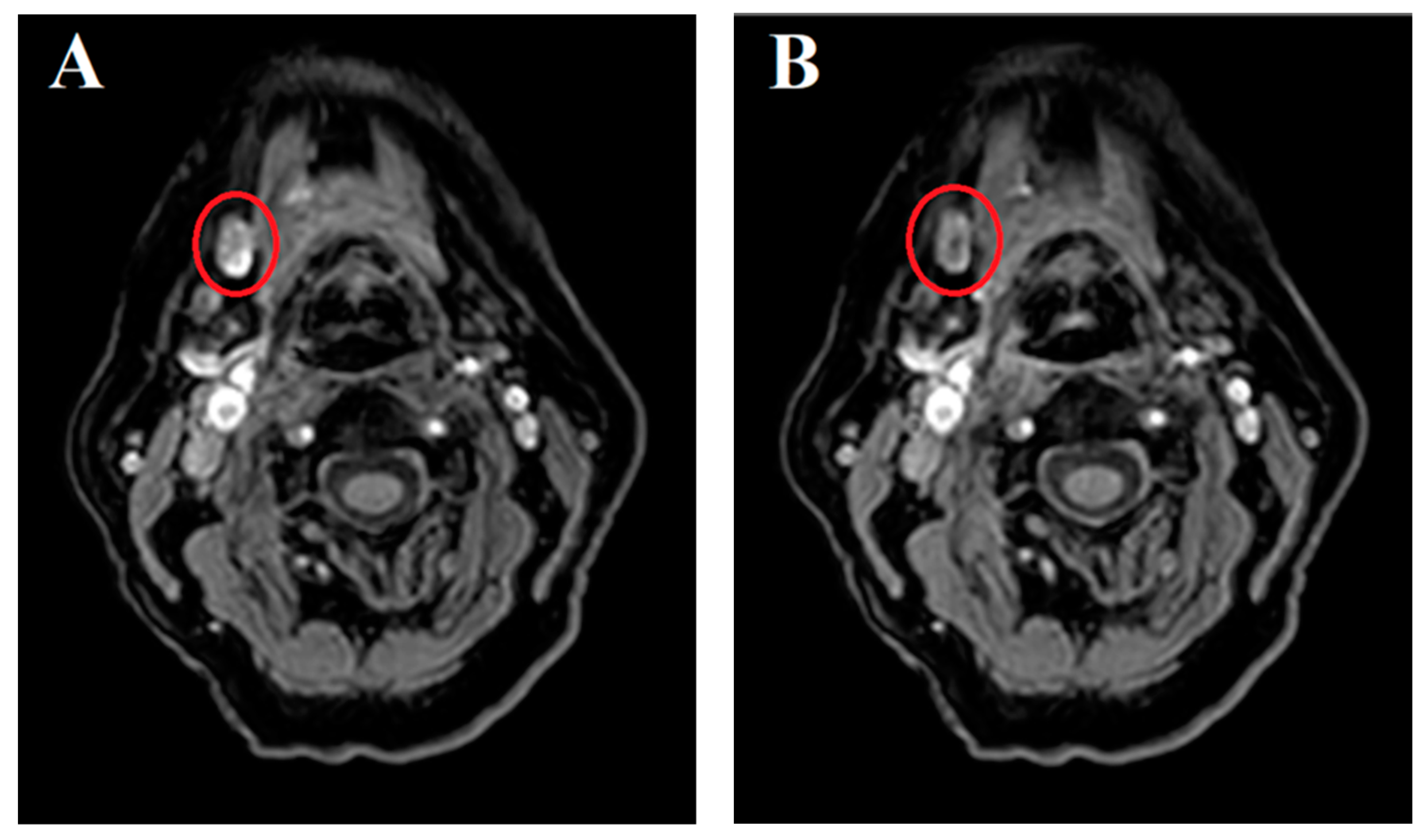 Jcm 13 07052 g003 Jcm 13 07052 g003