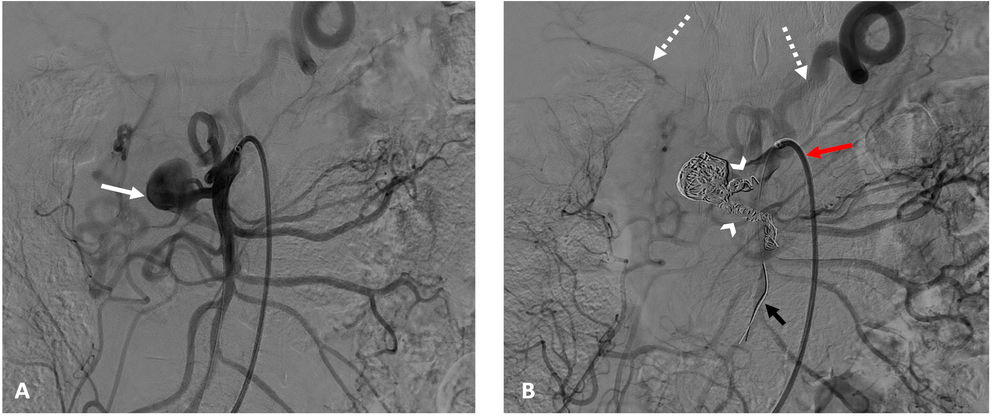 Jcm 13 07063 g002 Jcm 13 07063 g002
