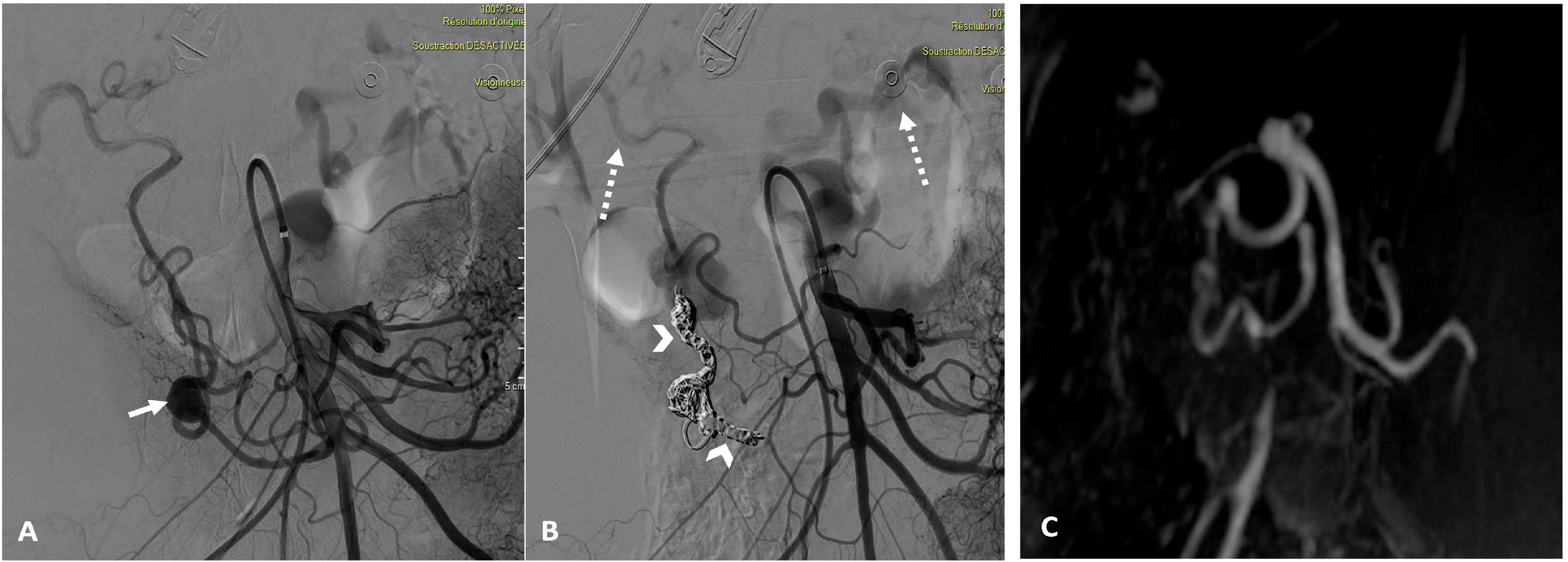 Jcm 13 07063 g003 Jcm 13 07063 g003