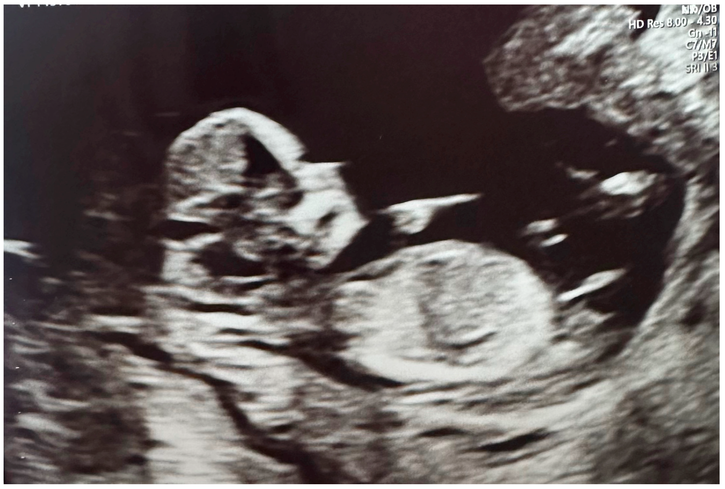 Jcm 13 07101 g002 Jcm 13 07101 g002