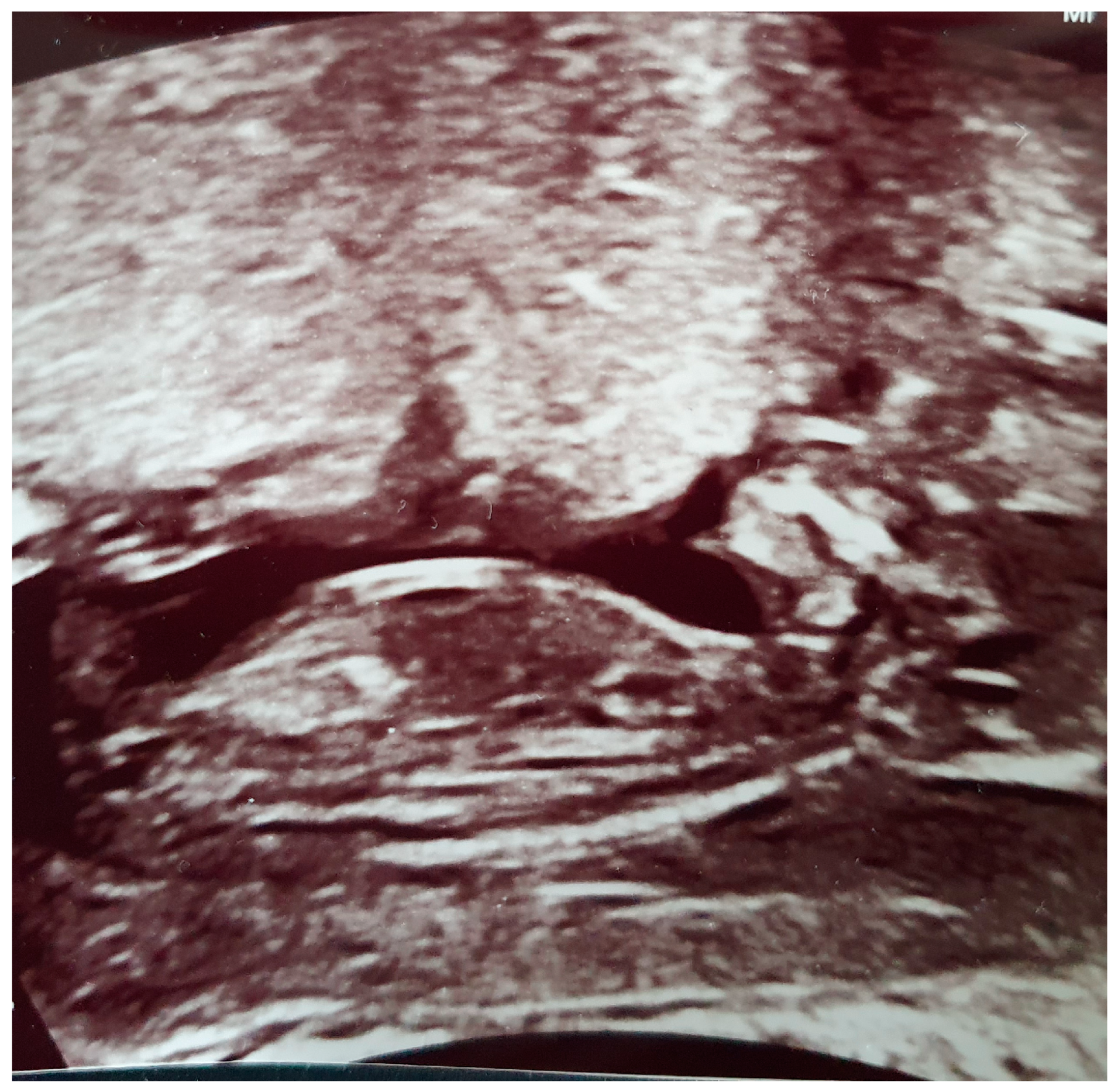 Jcm 13 07101 g003 Jcm 13 07101 g003