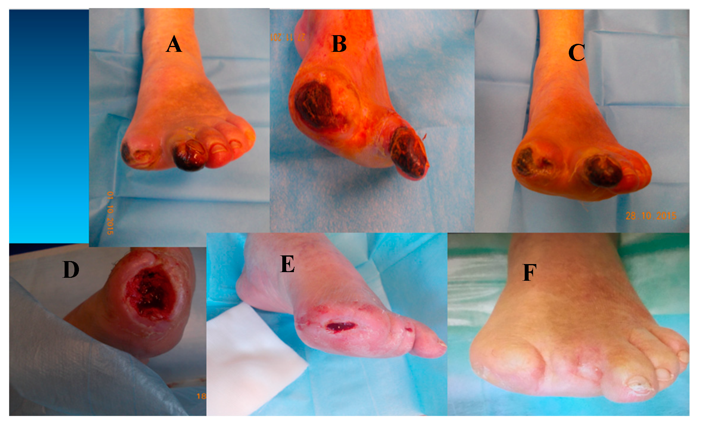 Jcm 13 07230 g004 Jcm 13 07230 g004