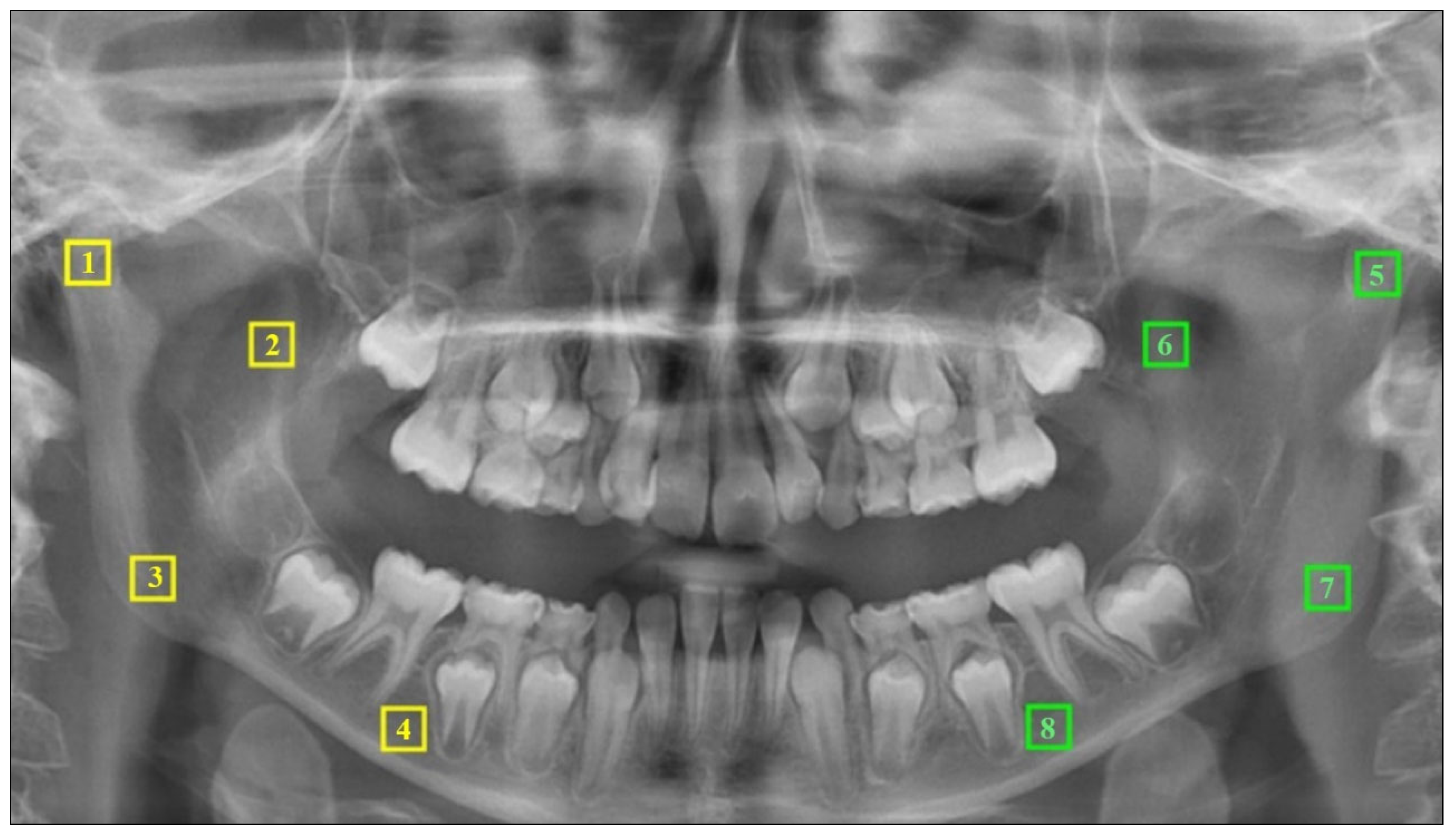 Jcm 13 07334 g003 Jcm 13 07334 g003