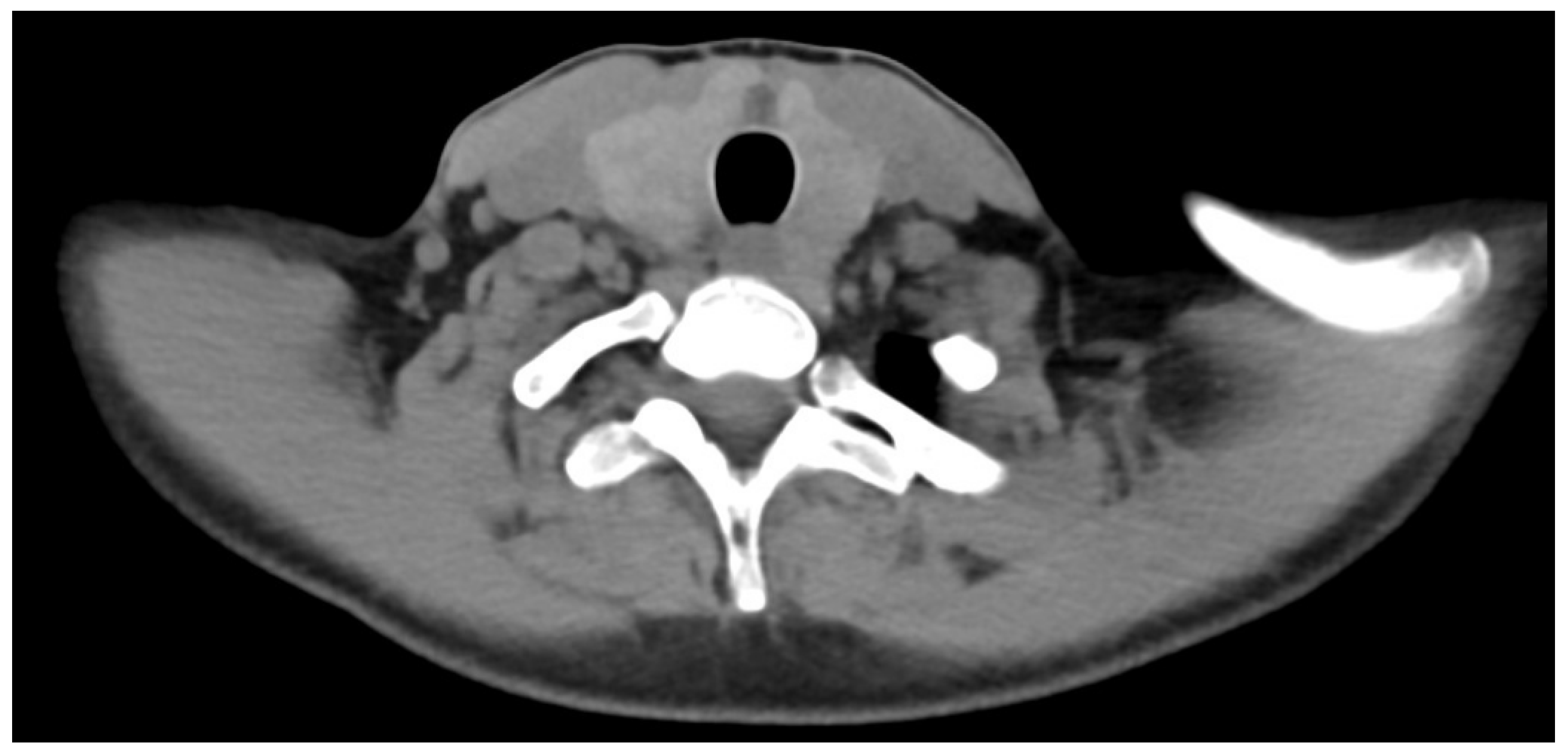 Jcm 13 07413 g002 Jcm 13 07413 g002