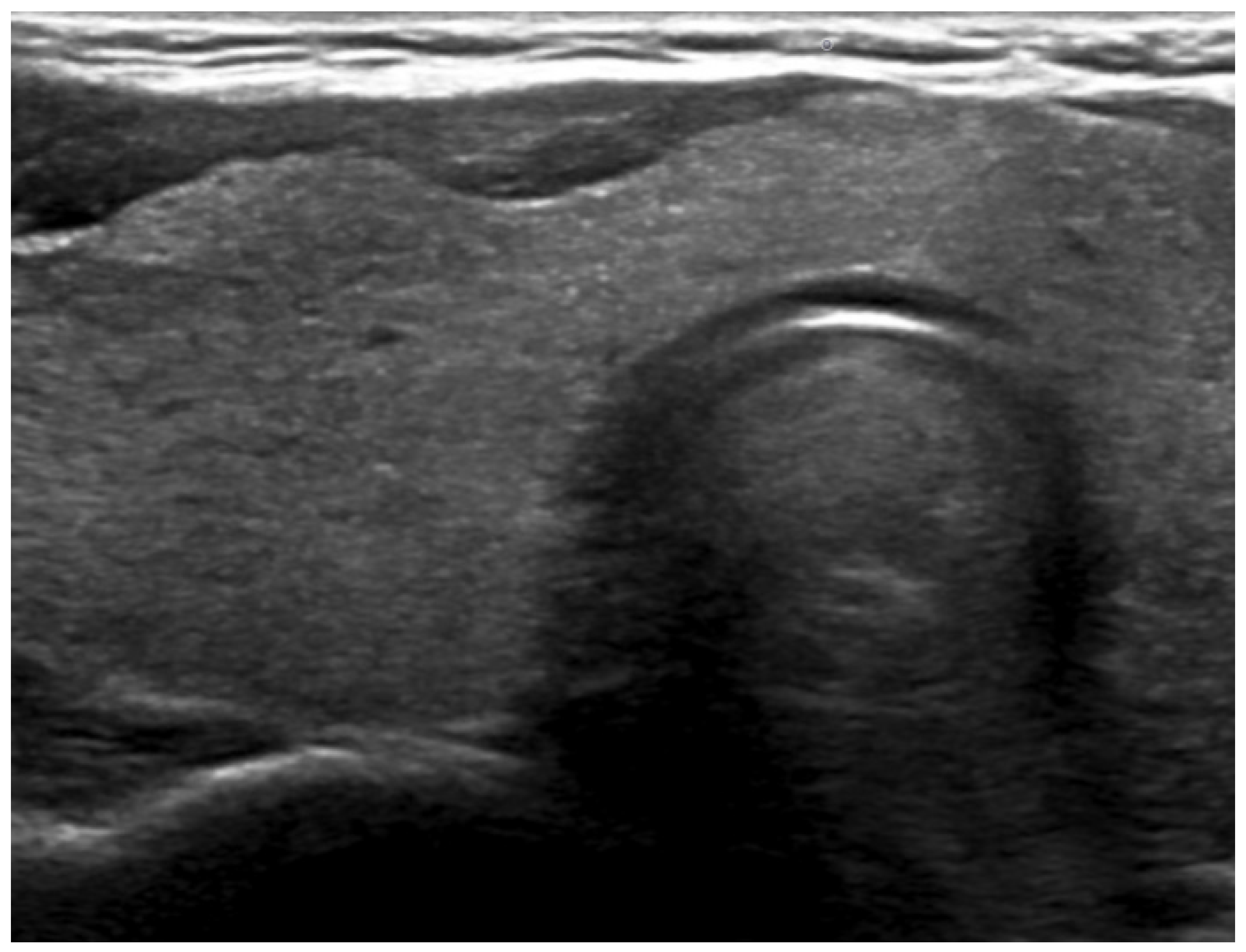 Jcm 13 07413 g003 Jcm 13 07413 g003