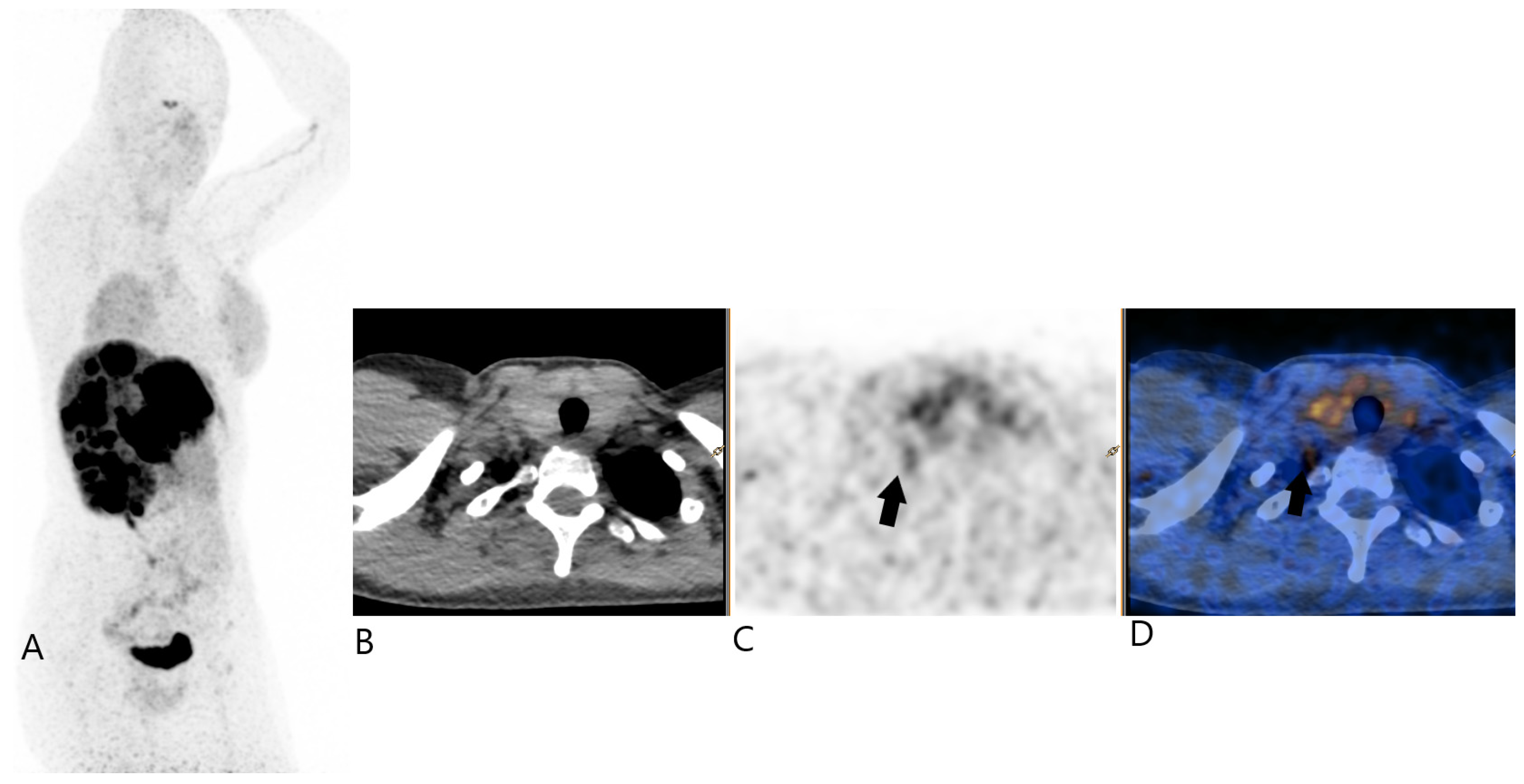 Jcm 13 07413 g004 Jcm 13 07413 g004