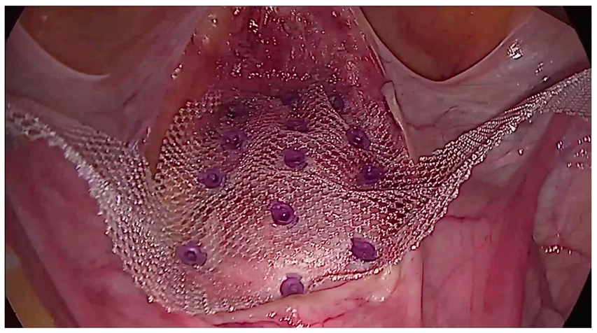 Jcm 13 07421 g002 Jcm 13 07421 g002