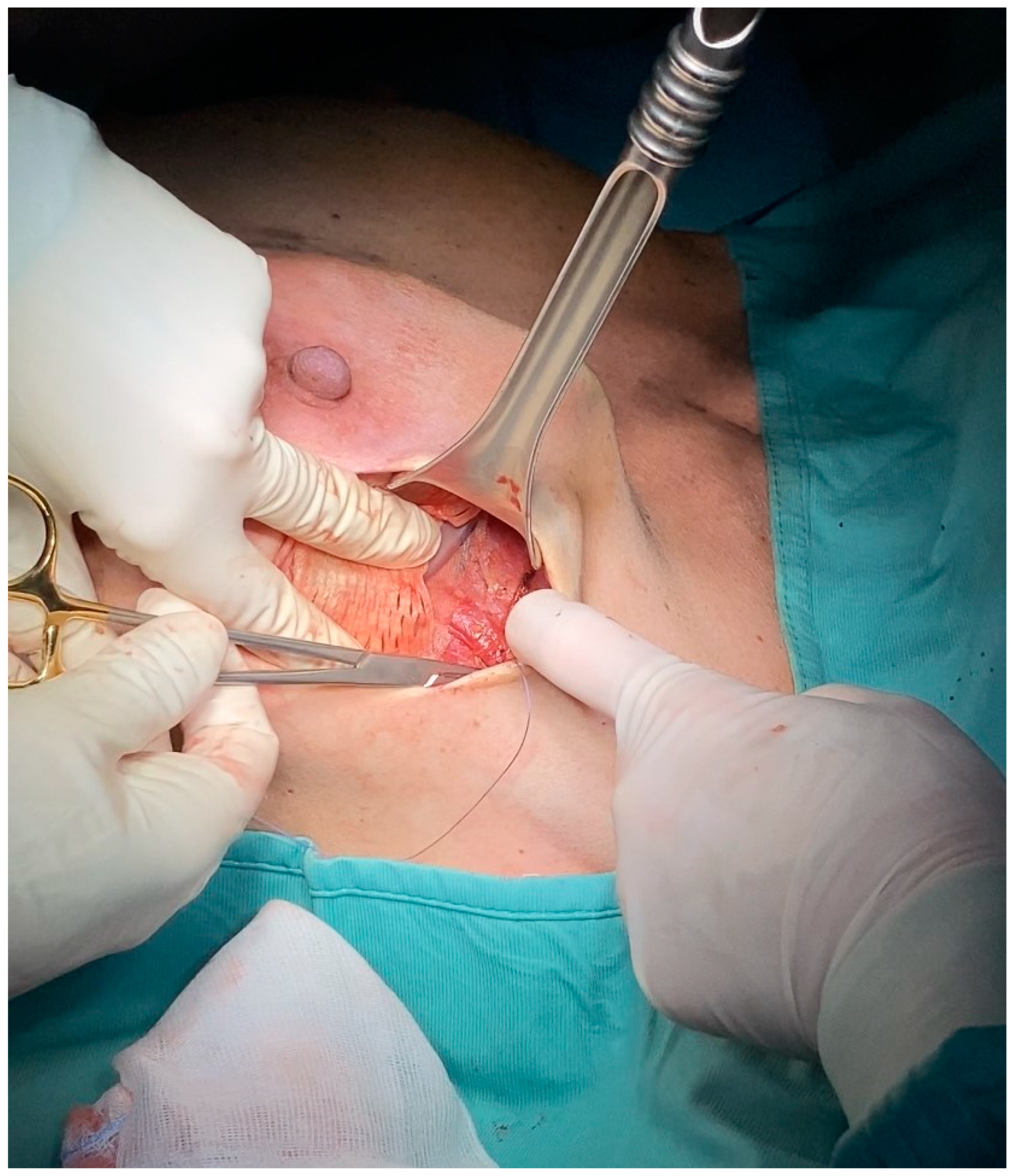 Jcm 13 07459 g002 Jcm 13 07459 g002