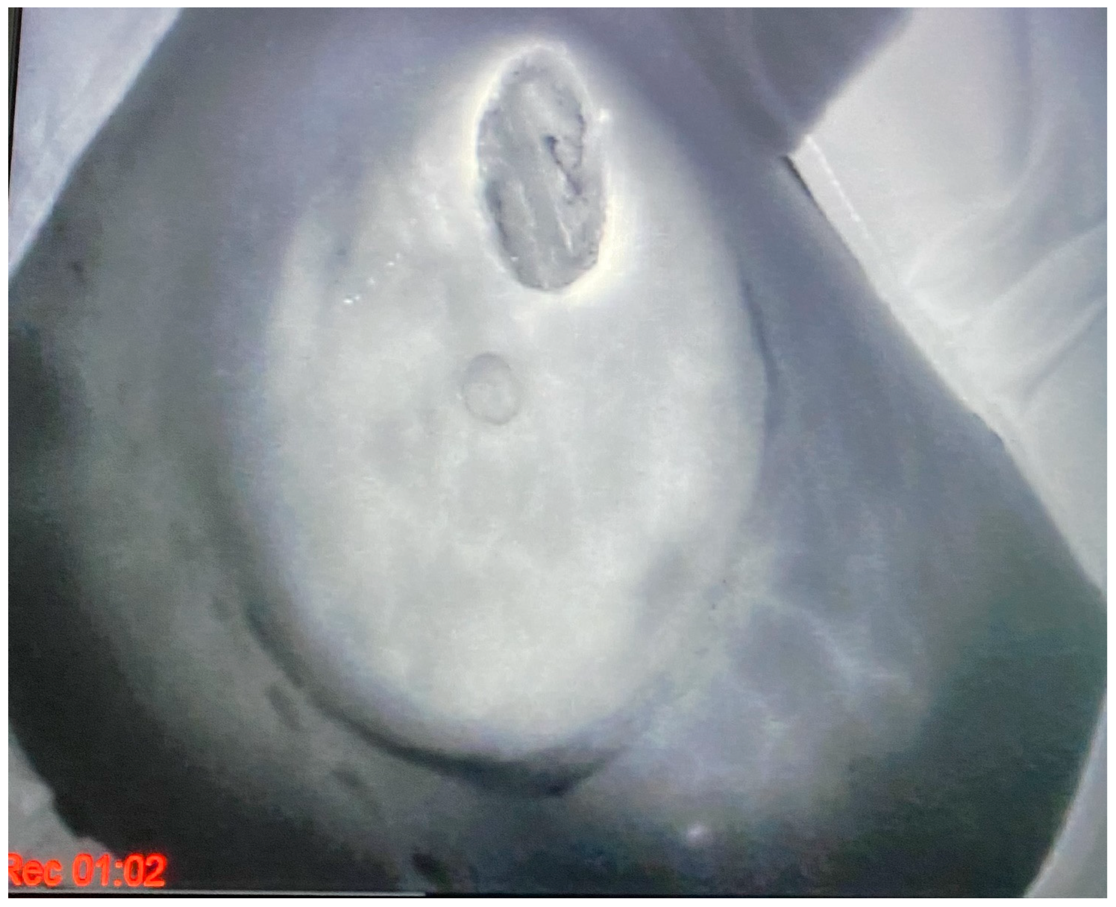 Jcm 13 07459 g004 Jcm 13 07459 g004