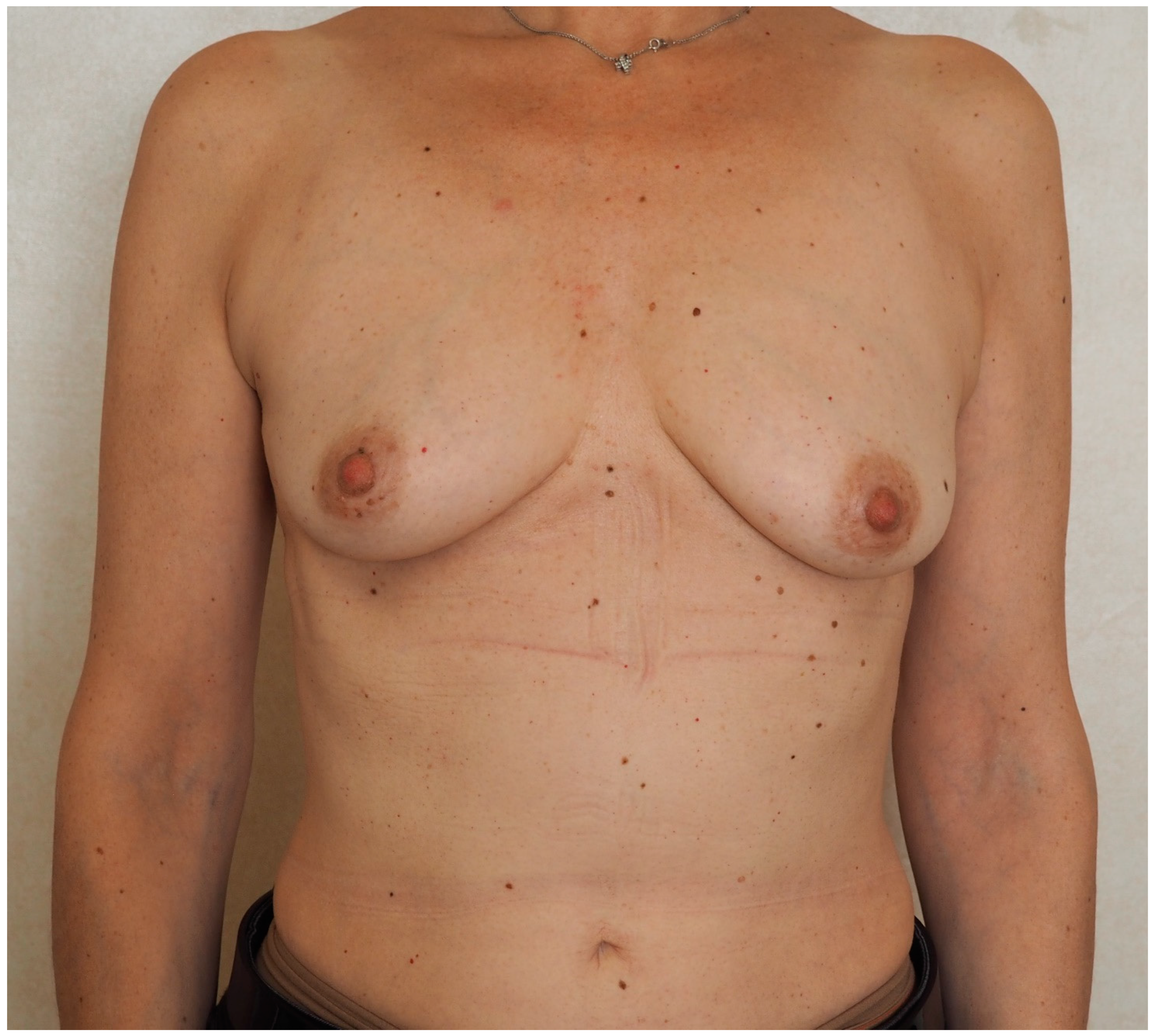 Jcm 13 07459 g005 Jcm 13 07459 g005