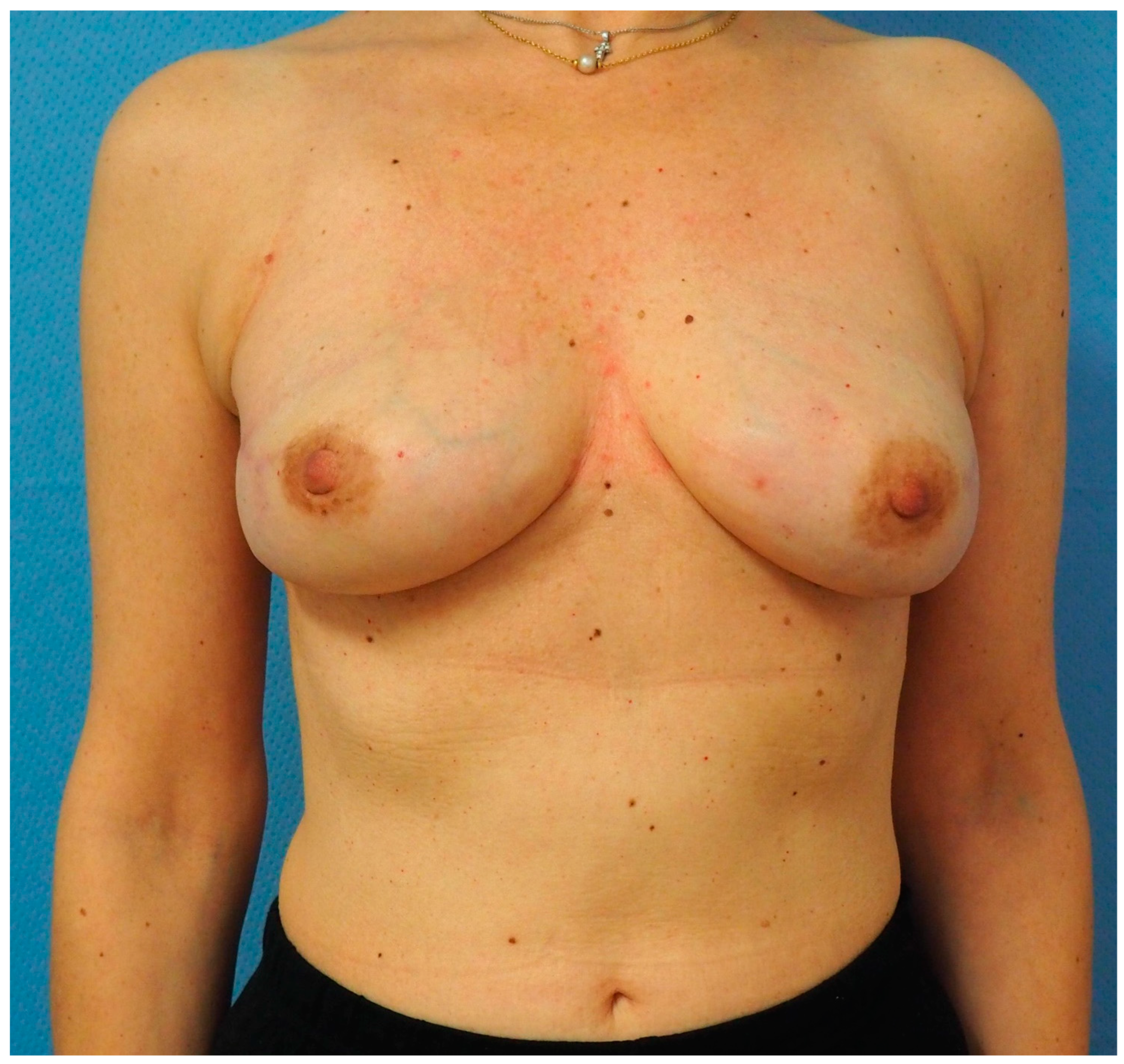 Jcm 13 07459 g006 Jcm 13 07459 g006