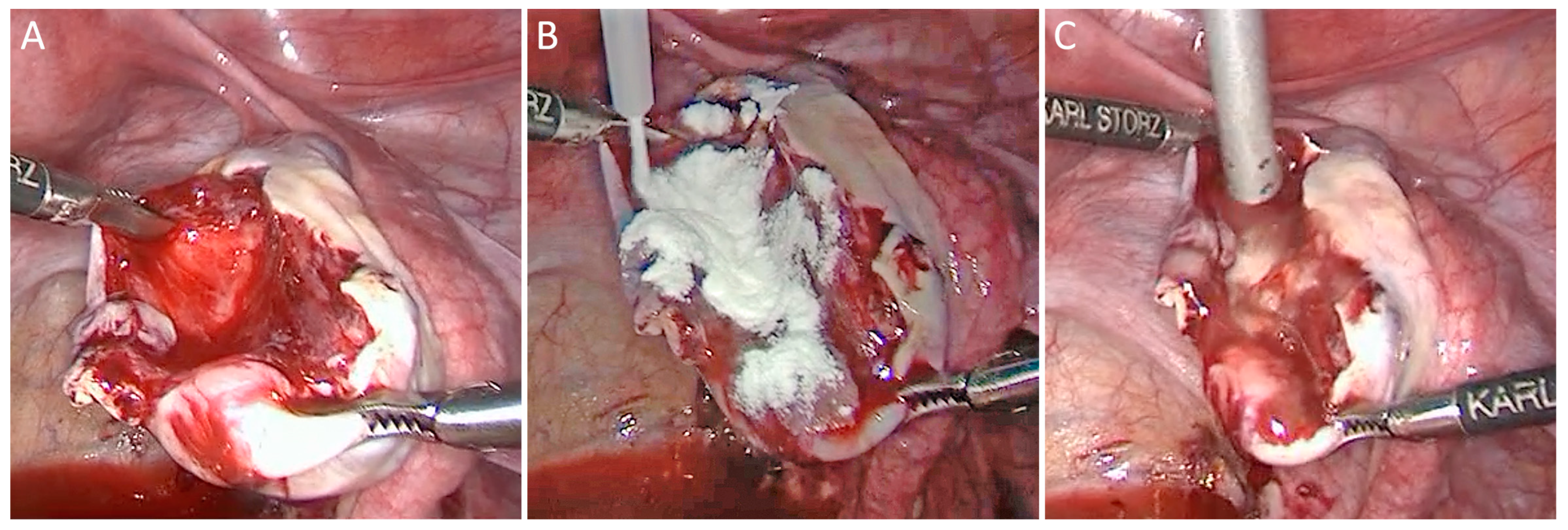 Jcm 13 07517 g004 Jcm 13 07517 g004