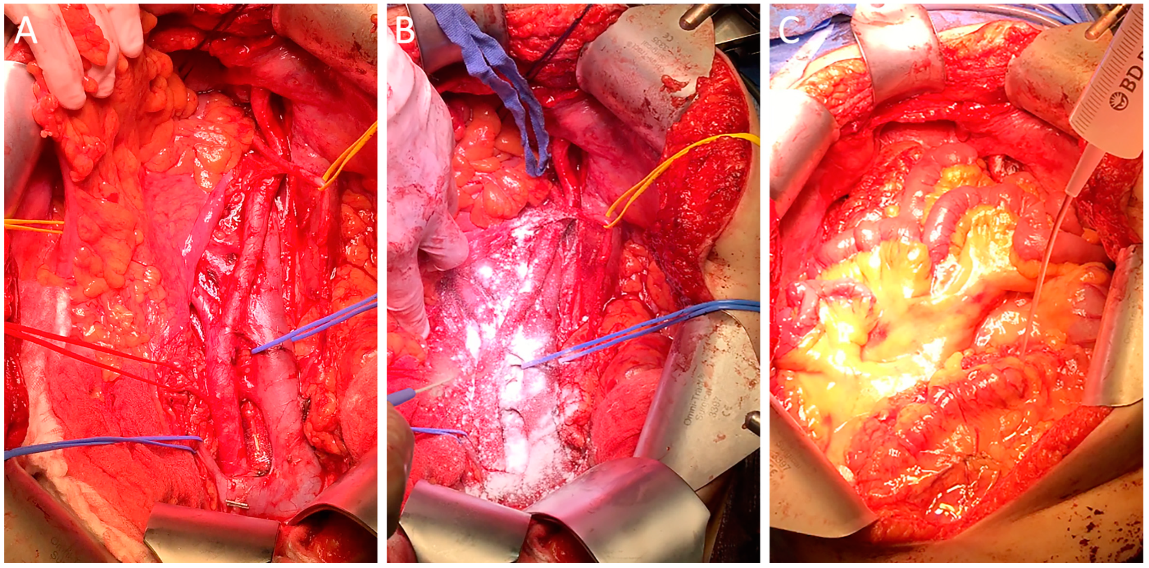 Jcm 13 07517 g005 Jcm 13 07517 g005