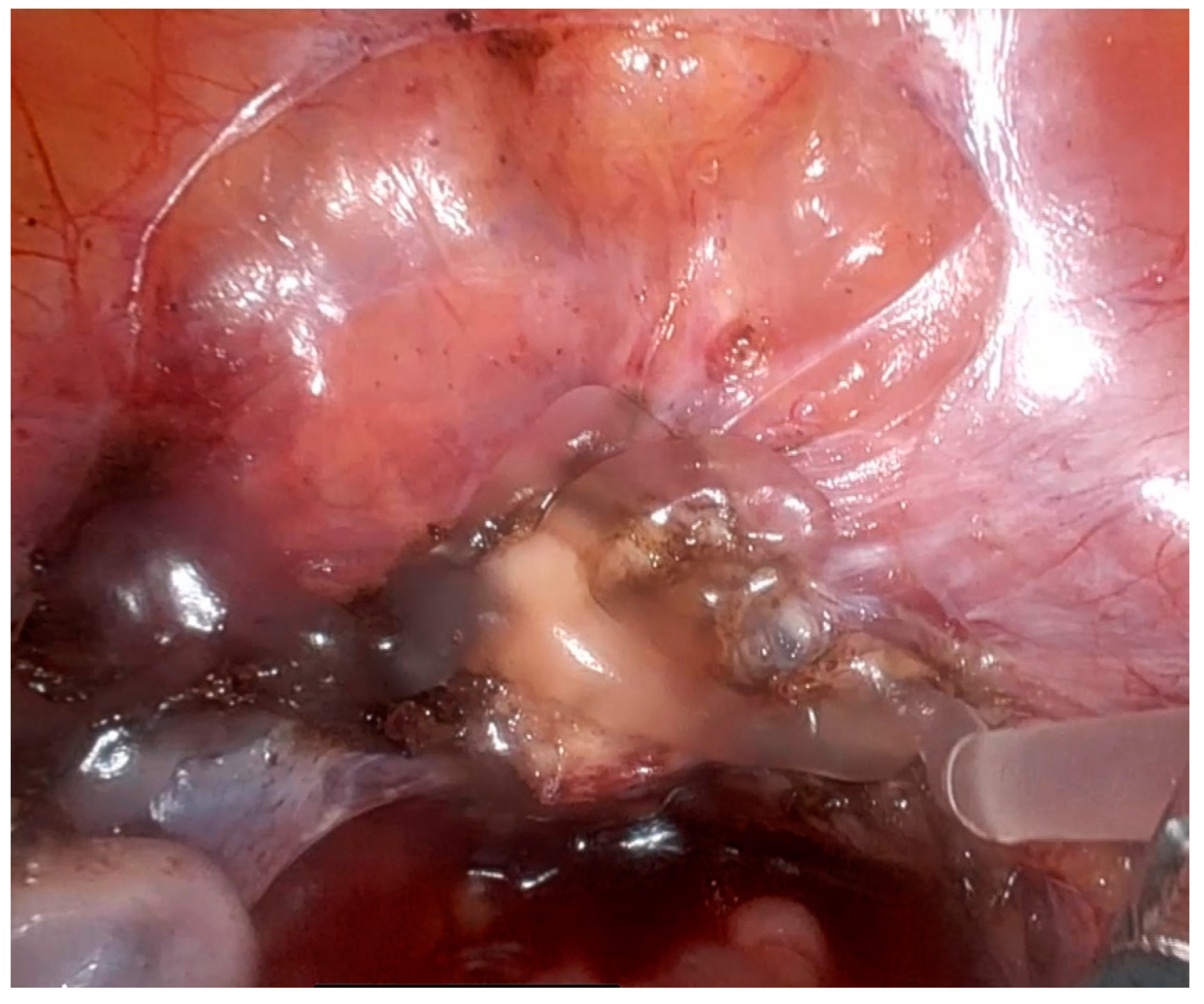 Jcm 13 07517 g007 Jcm 13 07517 g007