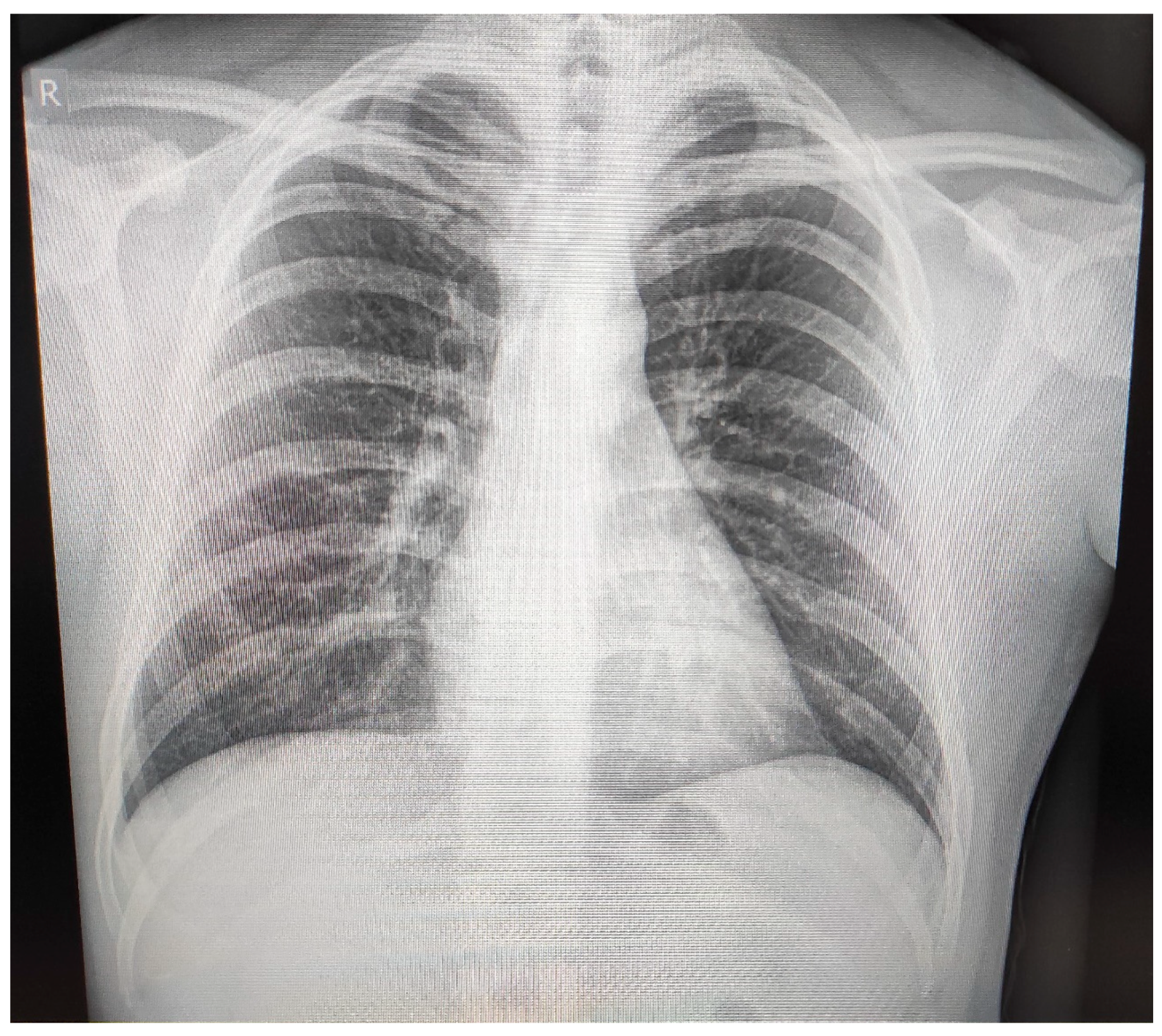 Jcm 13 07551 g001 Jcm 13 07551 g001