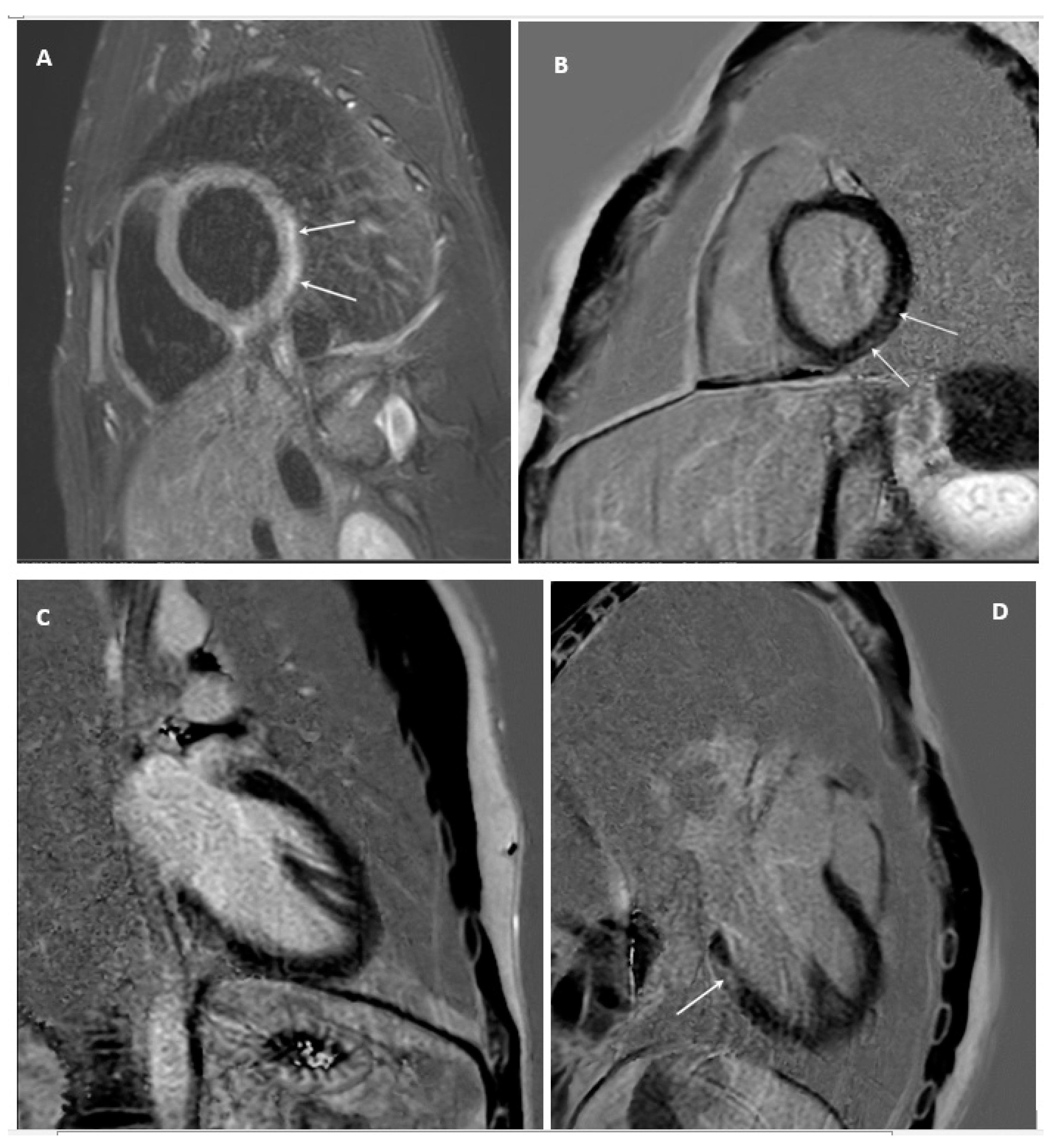 Jcm 13 07551 g004 Jcm 13 07551 g004