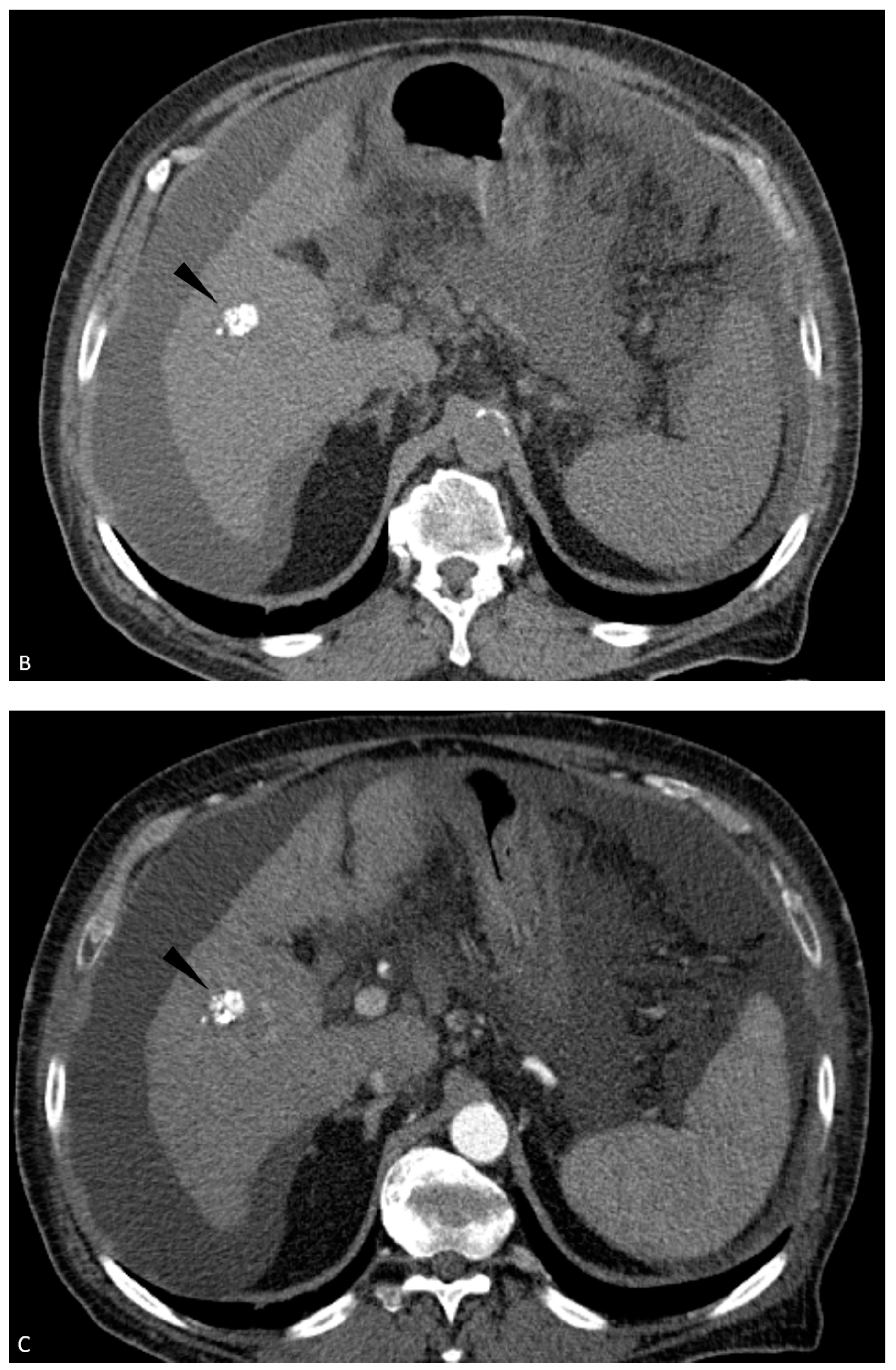 Jcm 13 07720 g001b Jcm 13 07720 g001b