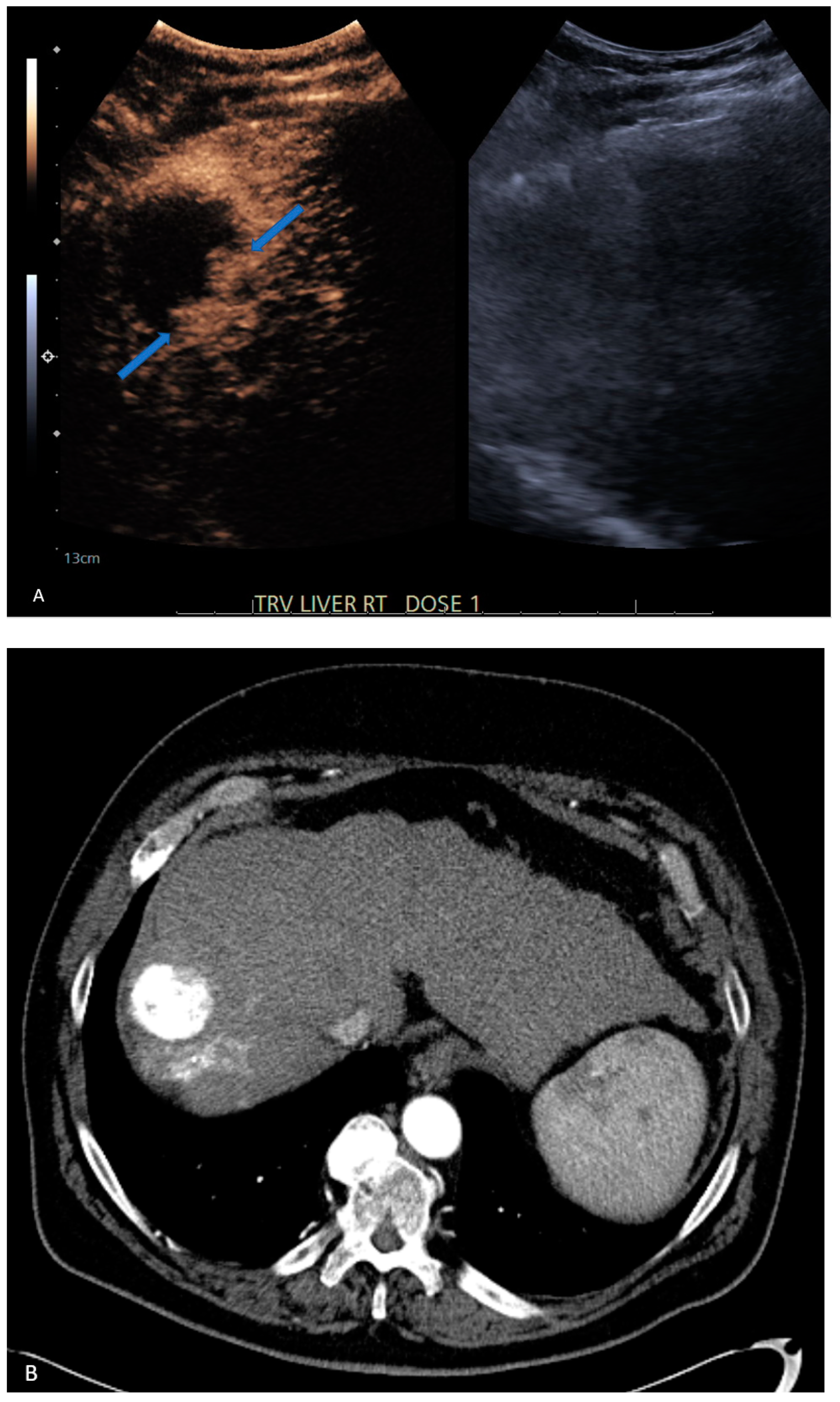 Jcm 13 07720 g002a Jcm 13 07720 g002a