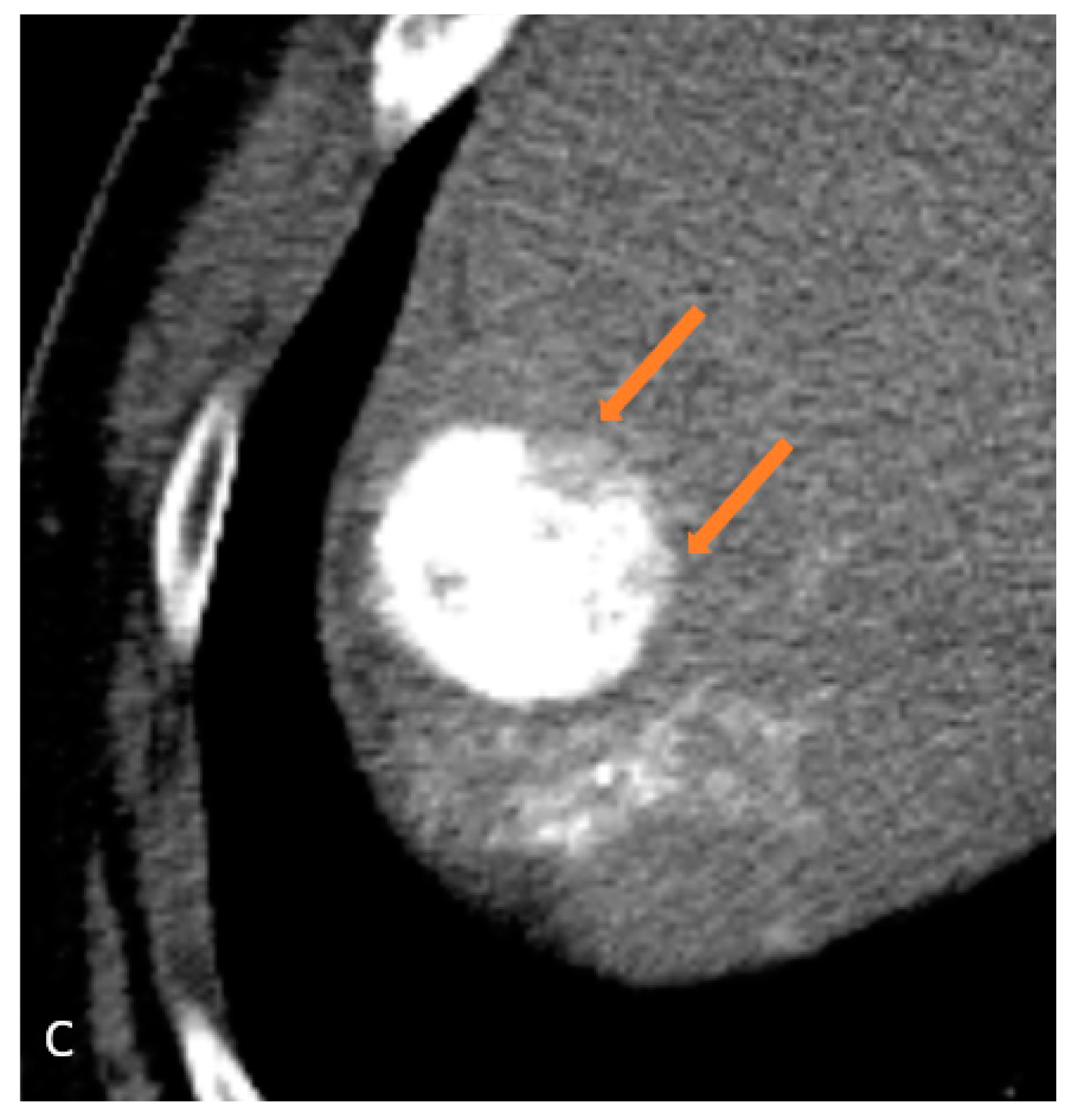 Jcm 13 07720 g002b Jcm 13 07720 g002b
