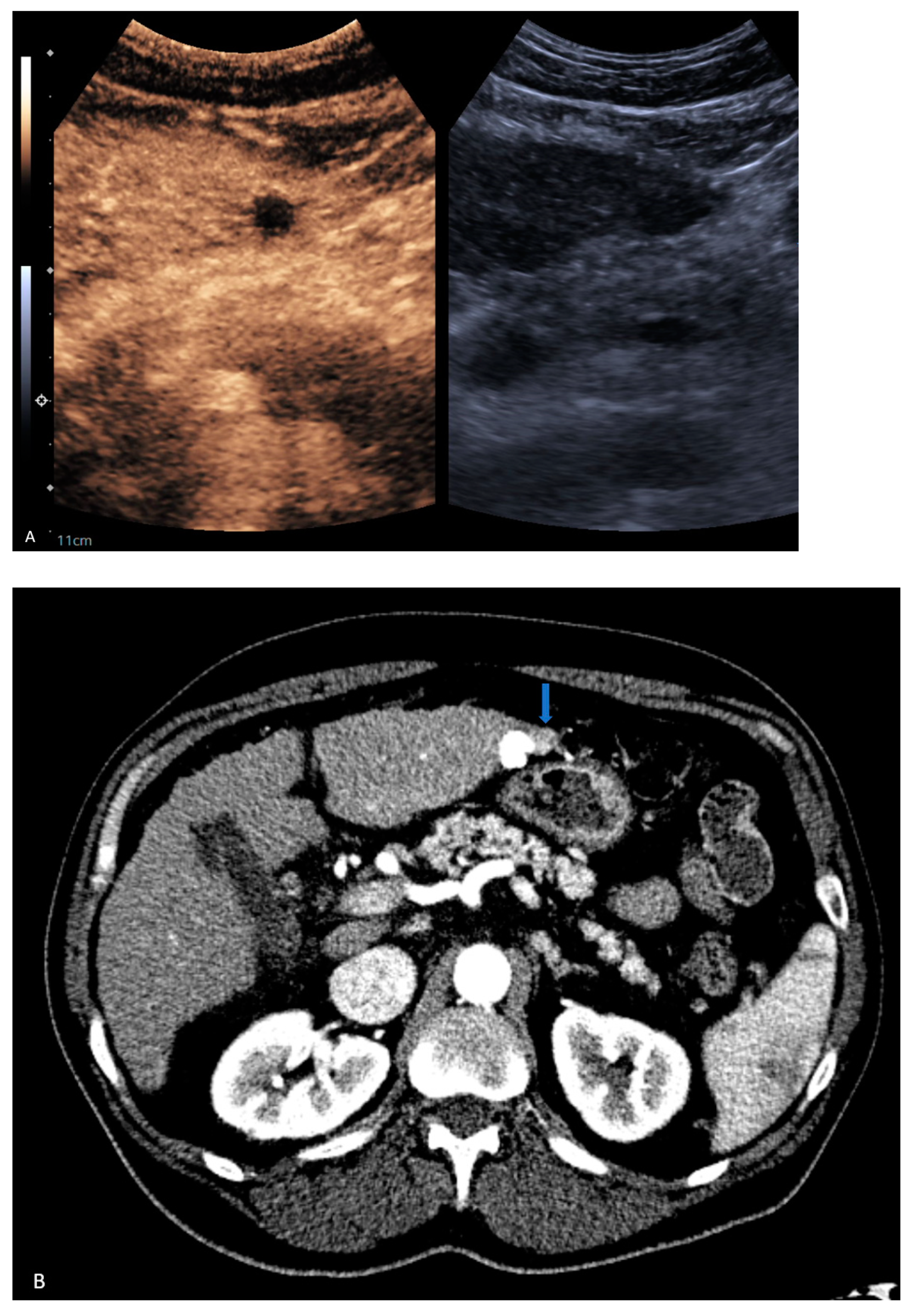 Jcm 13 07720 g003 Jcm 13 07720 g003