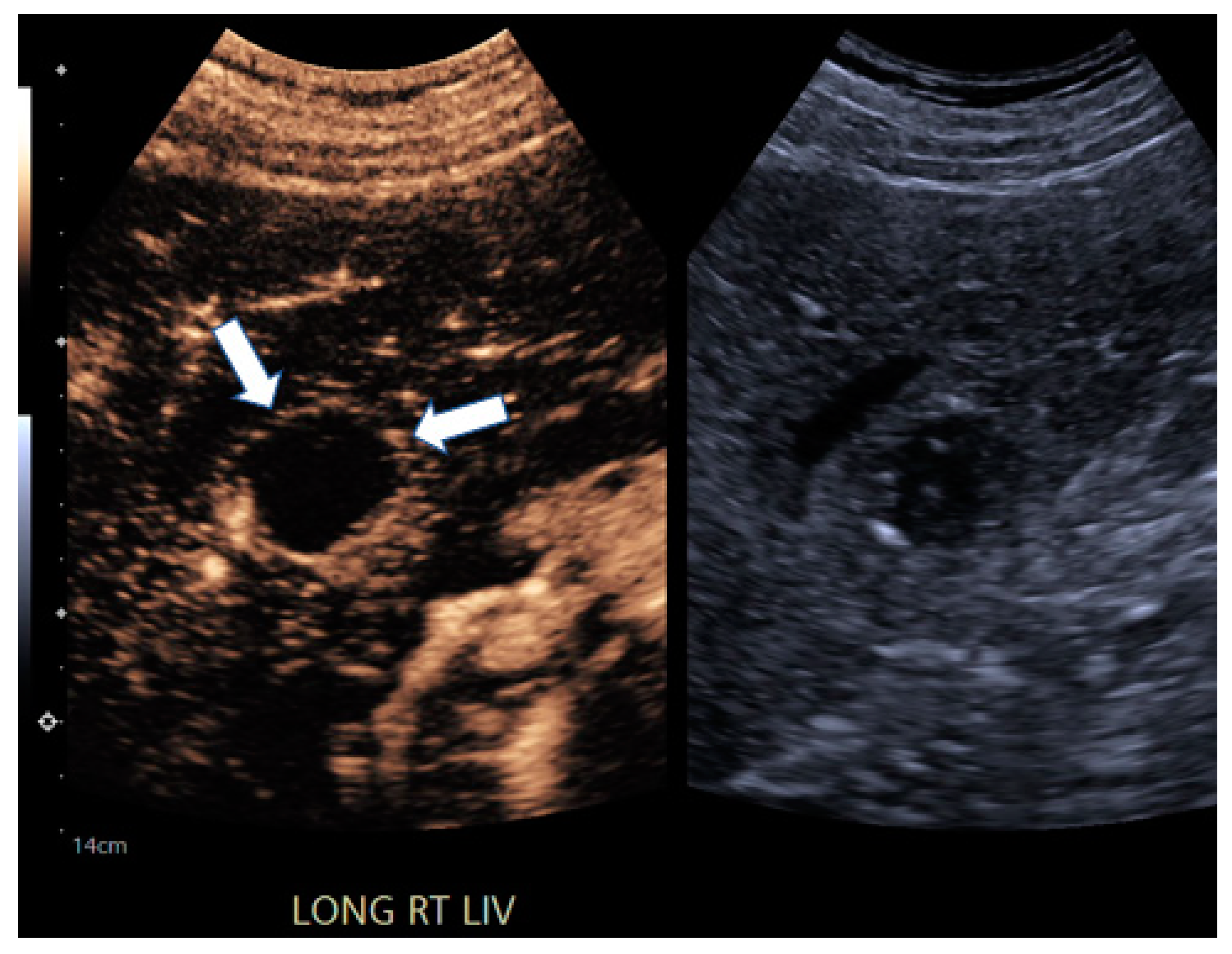Jcm 13 07720 g004 Jcm 13 07720 g004