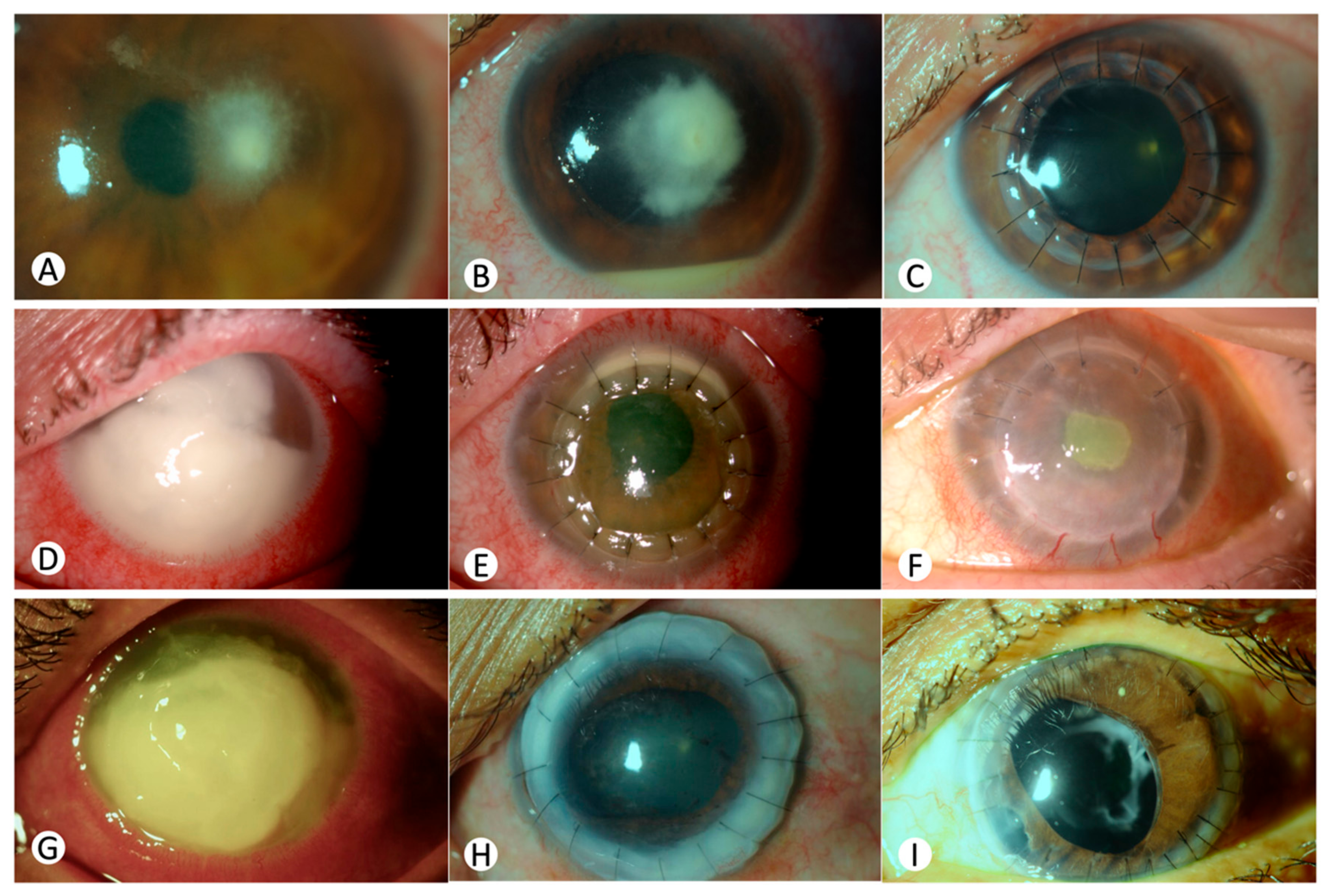 Jcm 13 07775 g001 Jcm 13 07775 g001