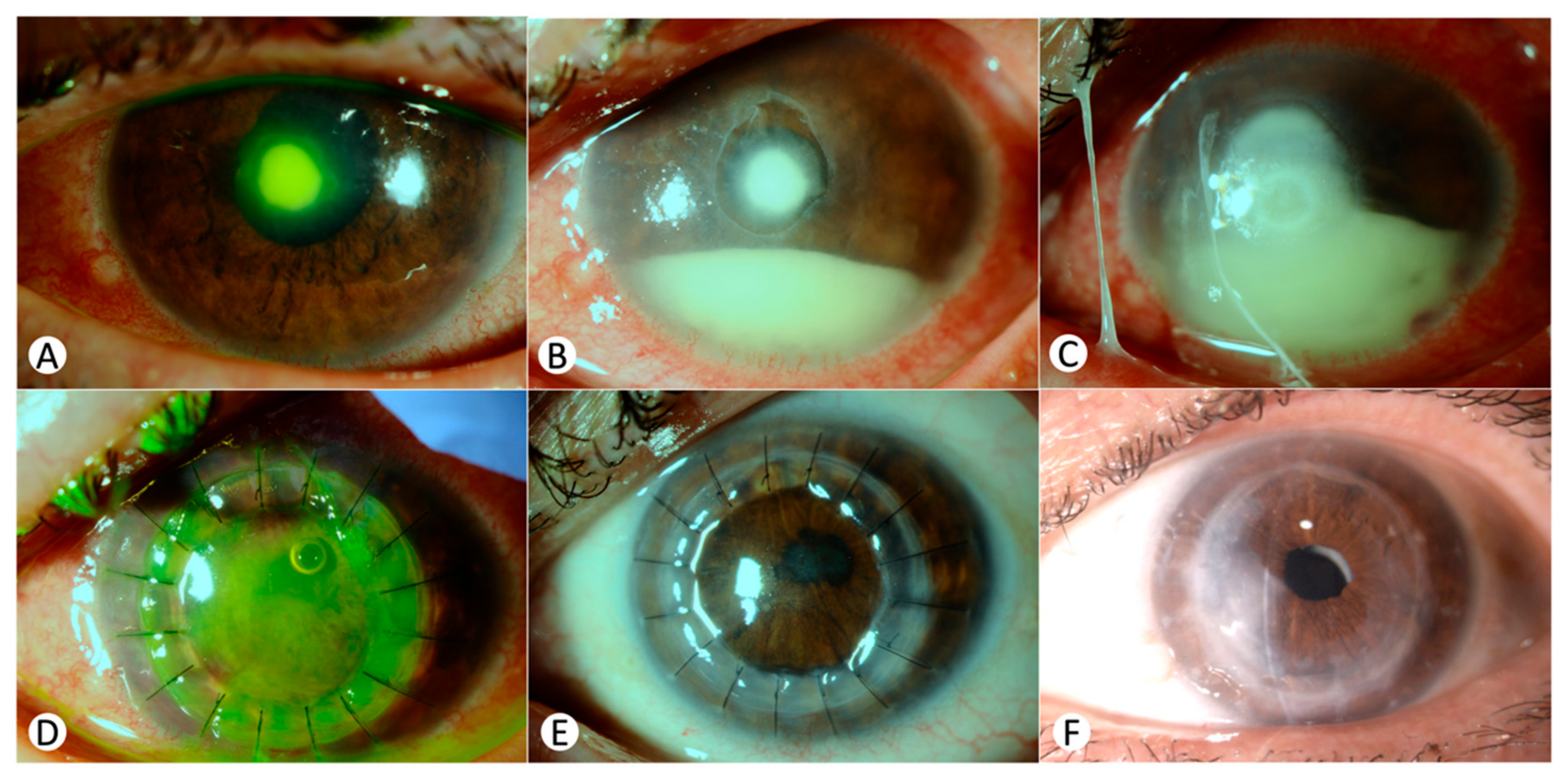 Jcm 13 07775 g002 Jcm 13 07775 g002