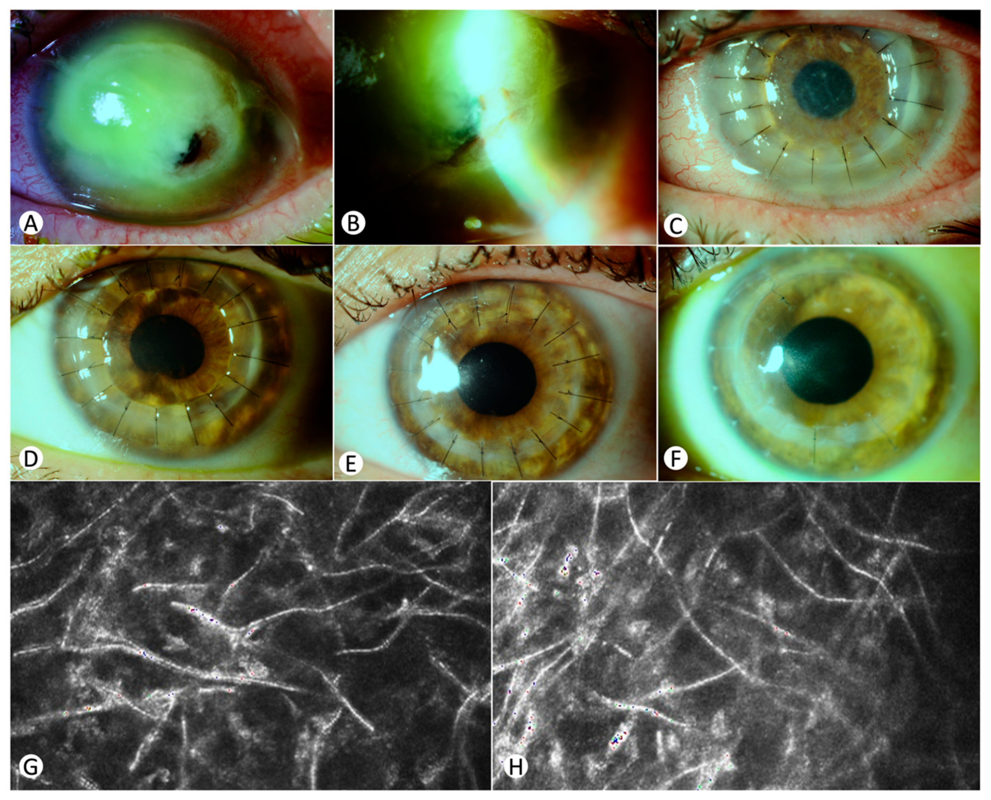 Jcm 13 07775 g003 Jcm 13 07775 g003