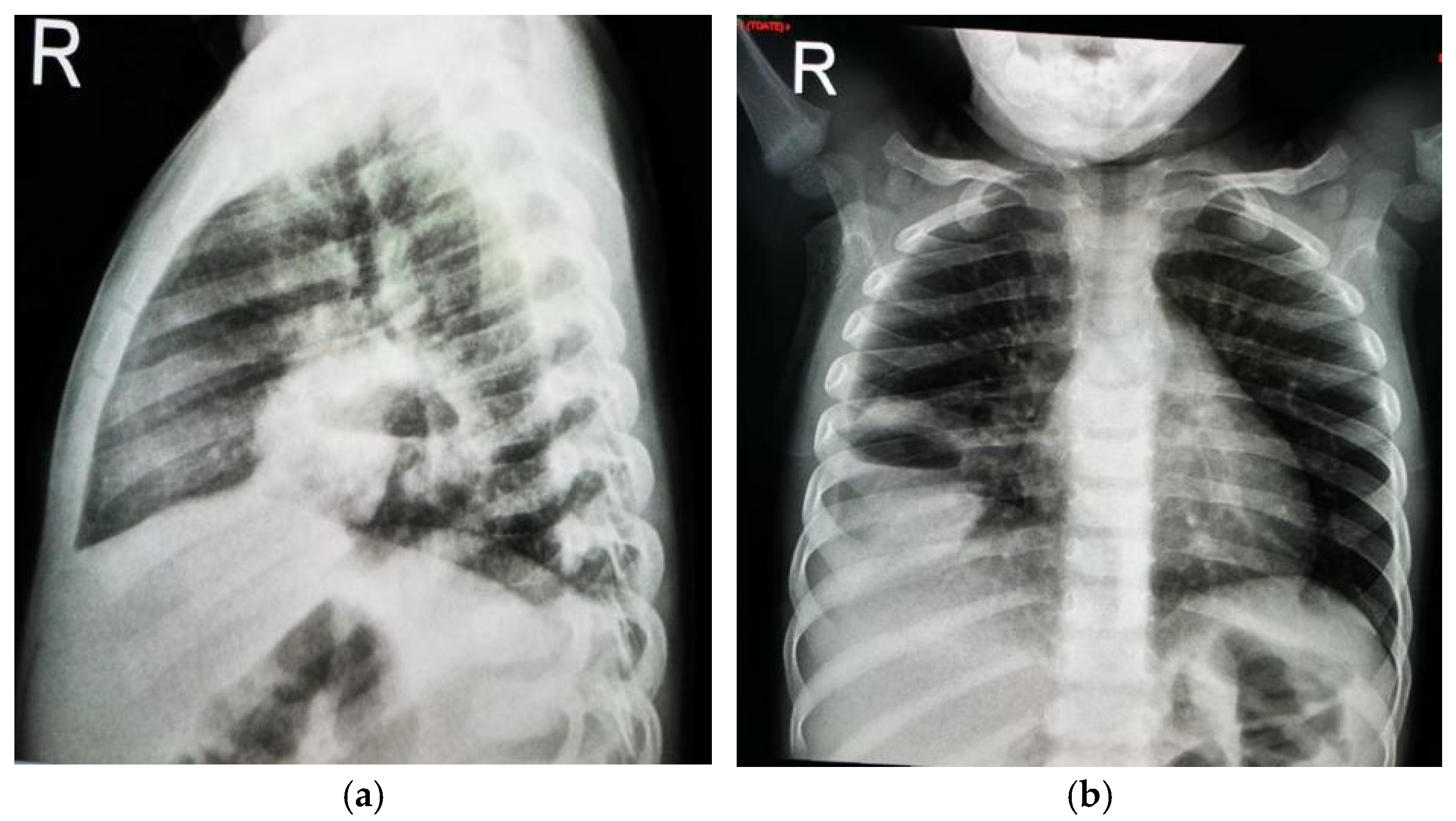 Jcm 13 07790 g001 Jcm 13 07790 g001