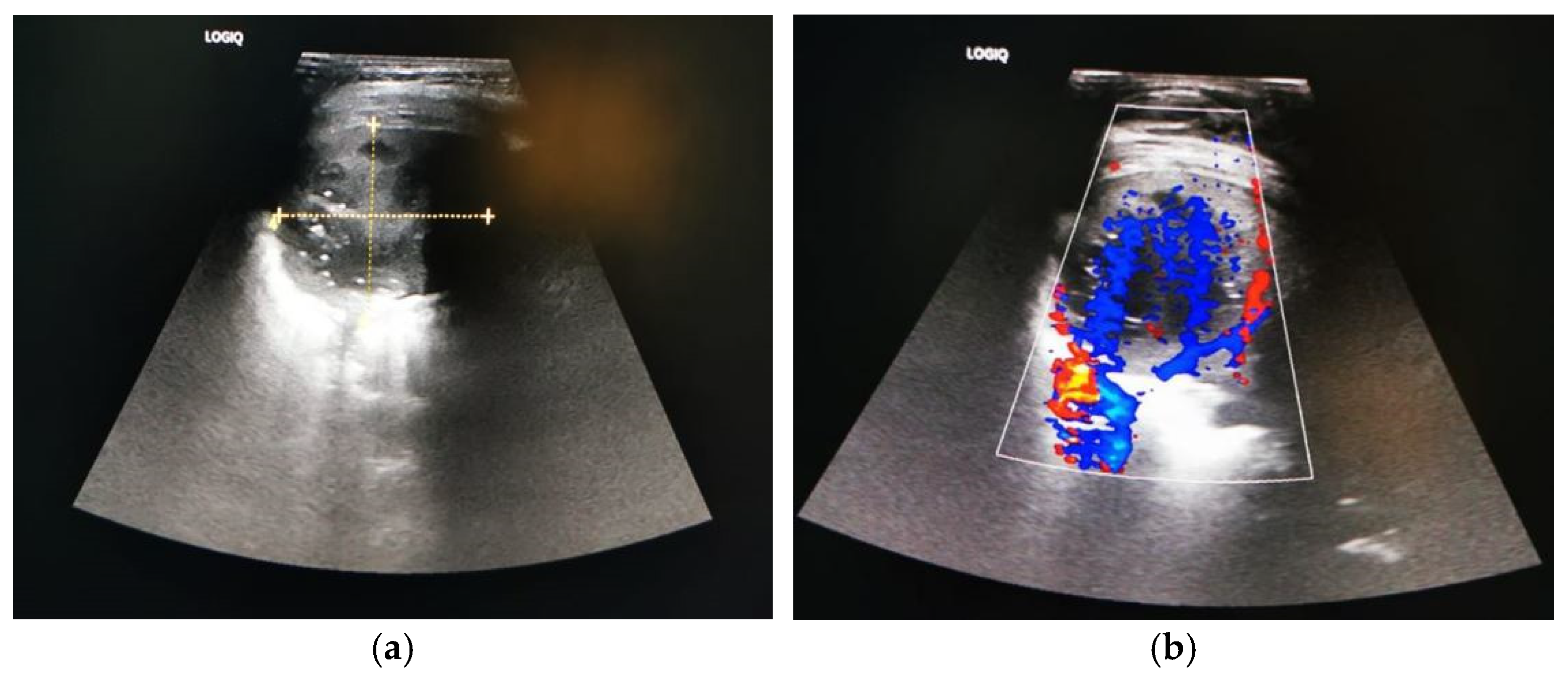 Jcm 13 07790 g002 Jcm 13 07790 g002