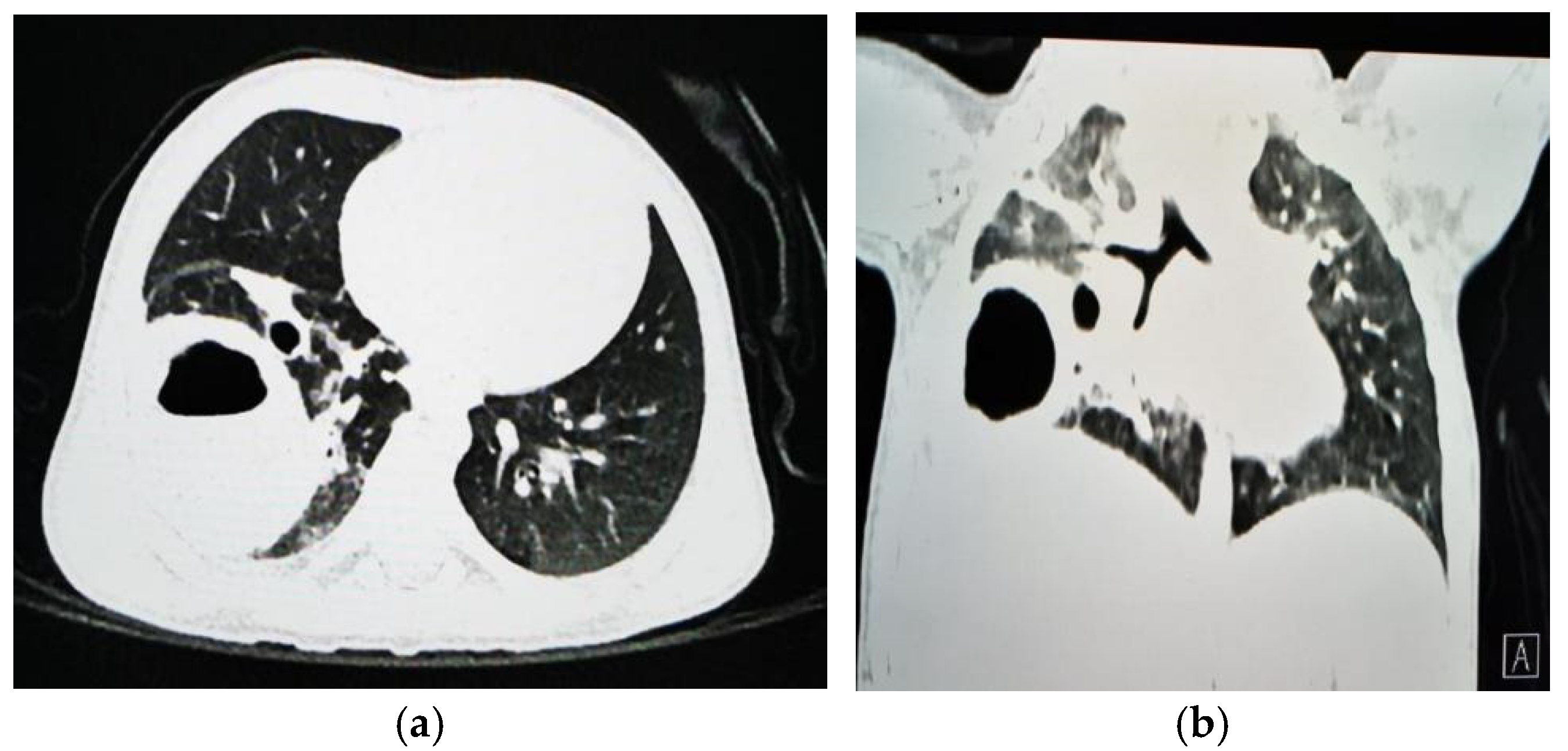 Jcm 13 07790 g003 Jcm 13 07790 g003