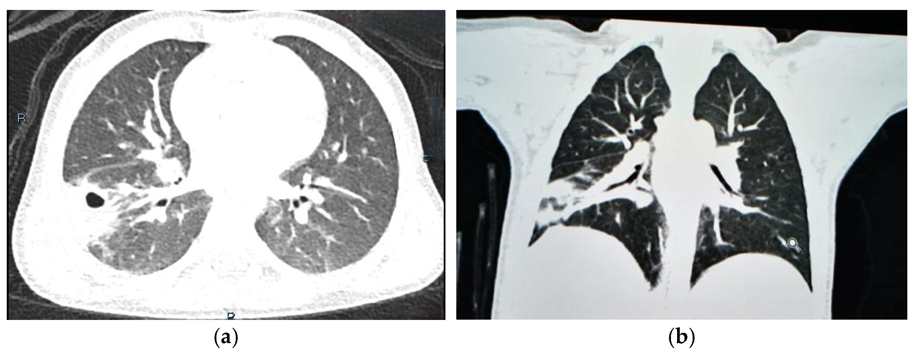 Jcm 13 07790 g004 Jcm 13 07790 g004