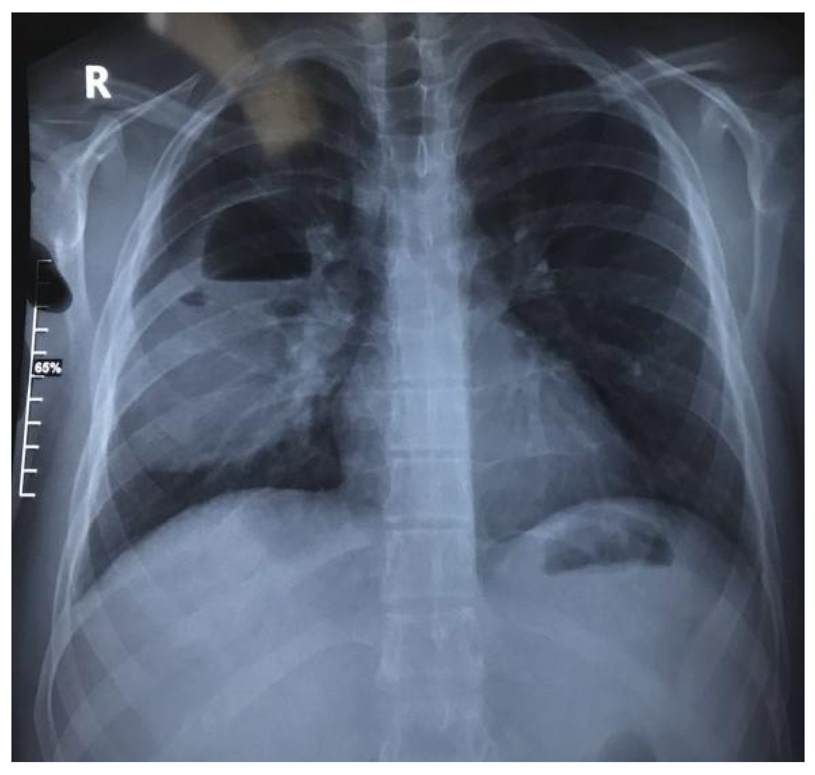 Jcm 13 07790 g006 Jcm 13 07790 g006