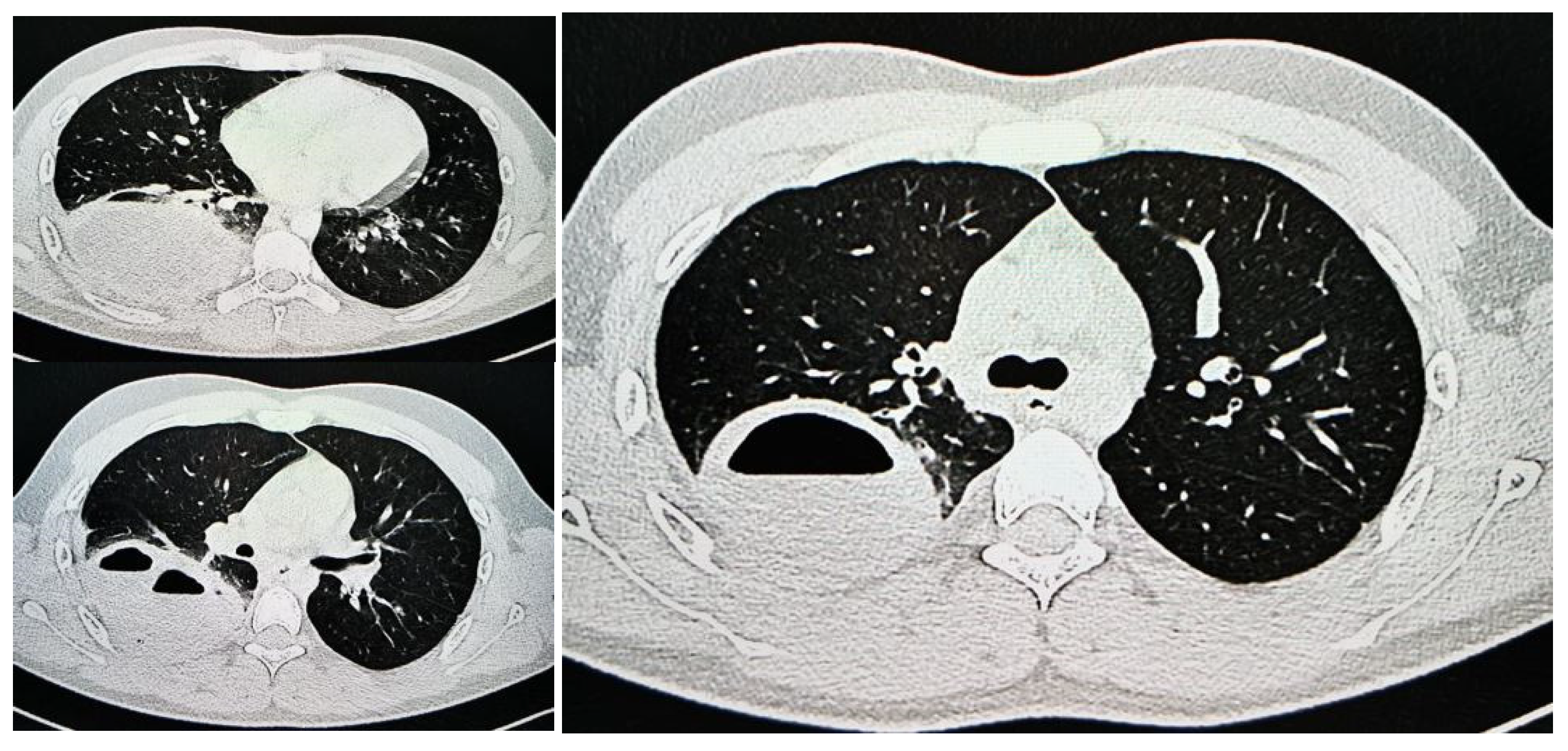 Jcm 13 07790 g007 Jcm 13 07790 g007