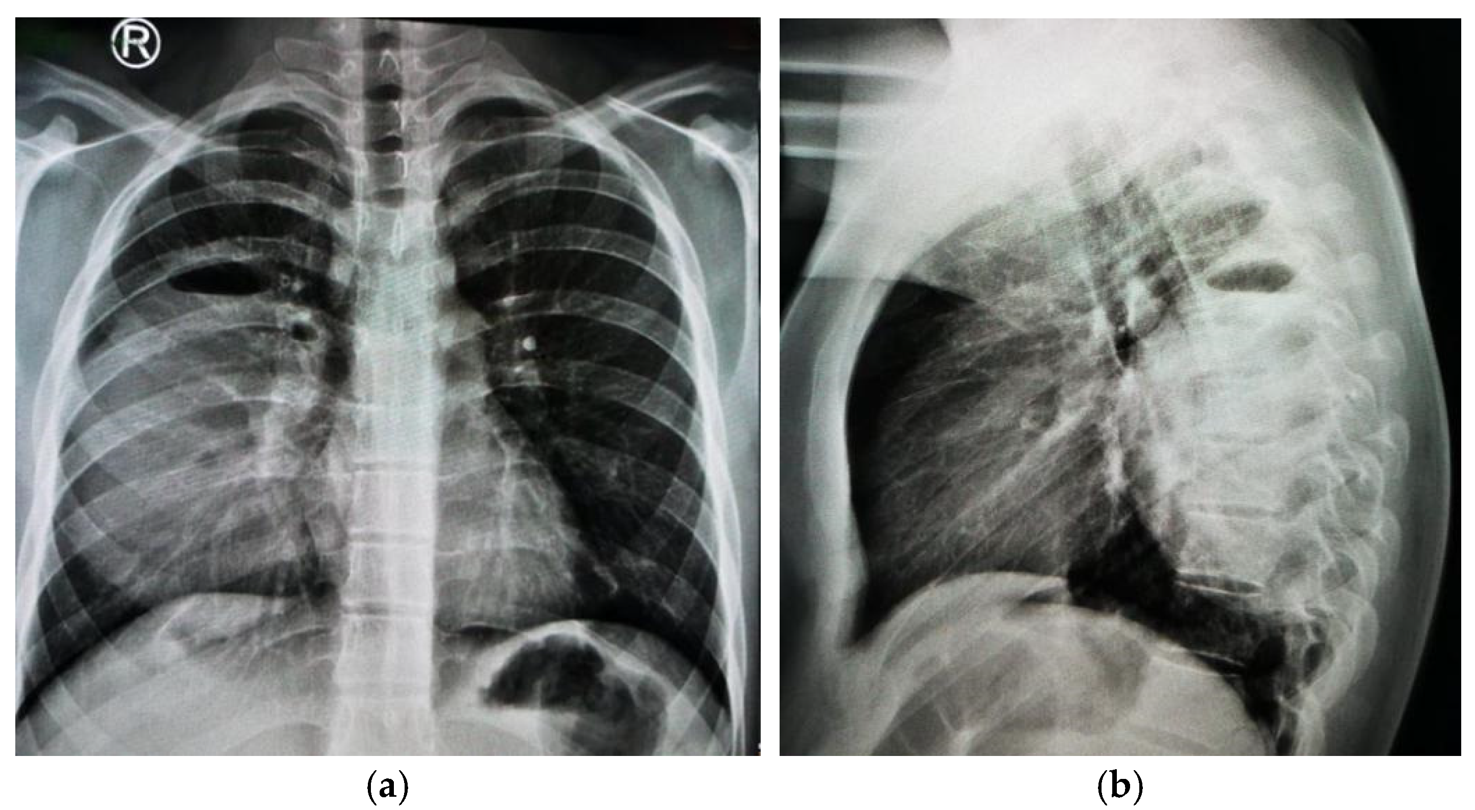Jcm 13 07790 g008 Jcm 13 07790 g008